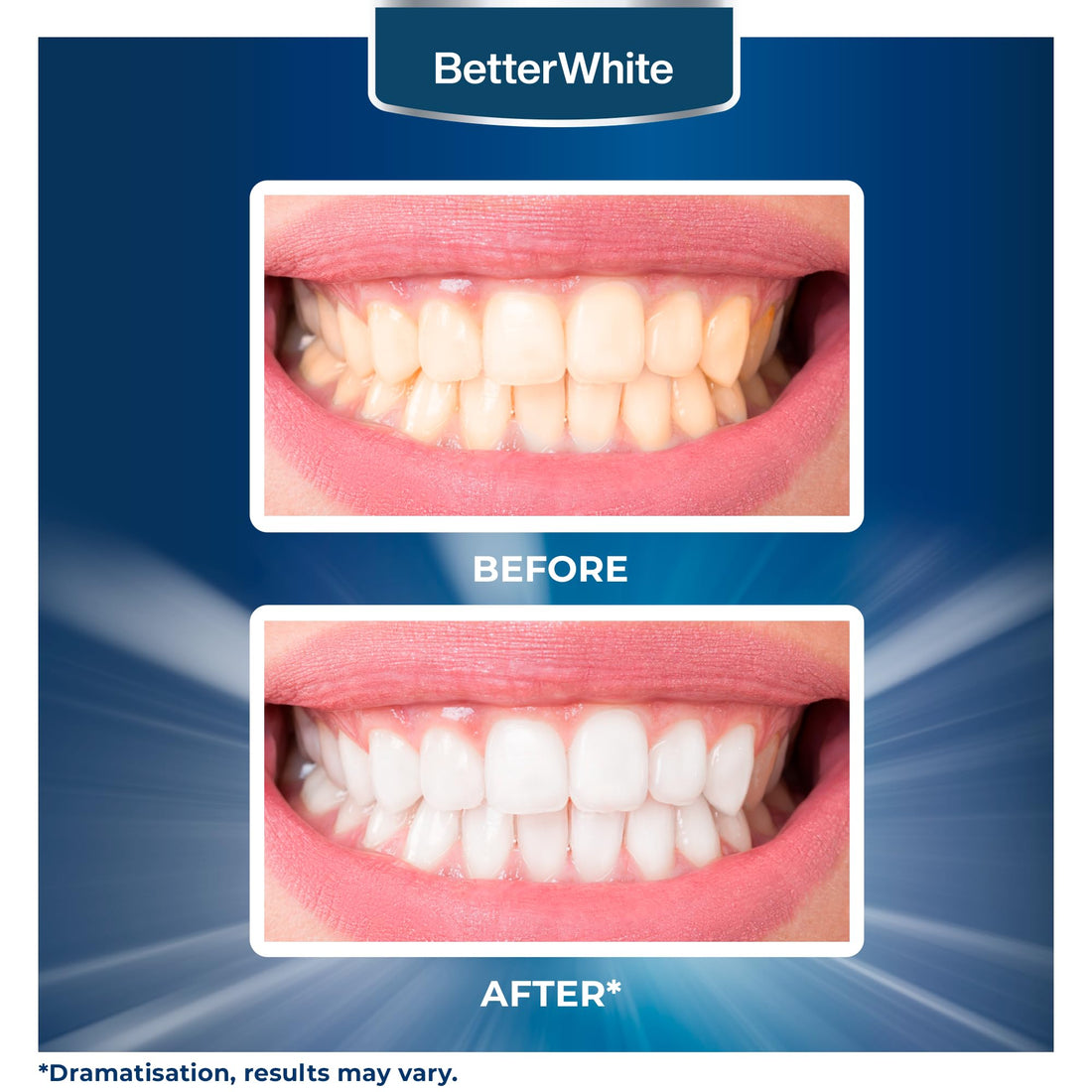 BetterWhite Teeth Whitening Powder - Dentist-Approved & Enamel-Safe | 6 Month Supply | Tea, Coffee, Wine & Smoking Stain Remover | Non-Sensitive Formula | Peroxide-Free | HAP, Baking Soda & Xylitol