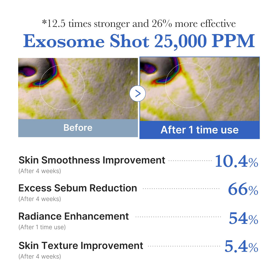 medicube Exosome Shot Zero 2,000 PPM Spicule Facial Serum | Liquid Skin Booster Serum | Exosome, AHA+BHA+PHA | Pore Care, Dead Skin Cells, Skin Texture | Korean Skincare, 1.01 fl.oz Halalzen
