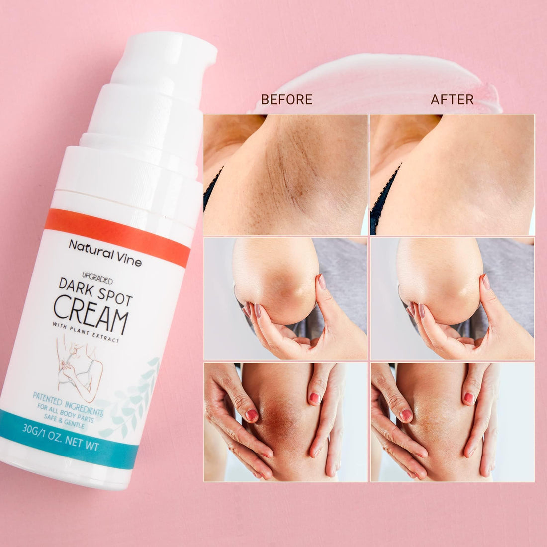 Natural Vine Dark Spot Corrector: Dark Spot Remover for Face Body in 4-8 Weeks - Instant Concealing & Age Brown Sun Faded Spot Remover Melasma Freckles Correcting with Niacinamide for Women & Men 60g Halalzen