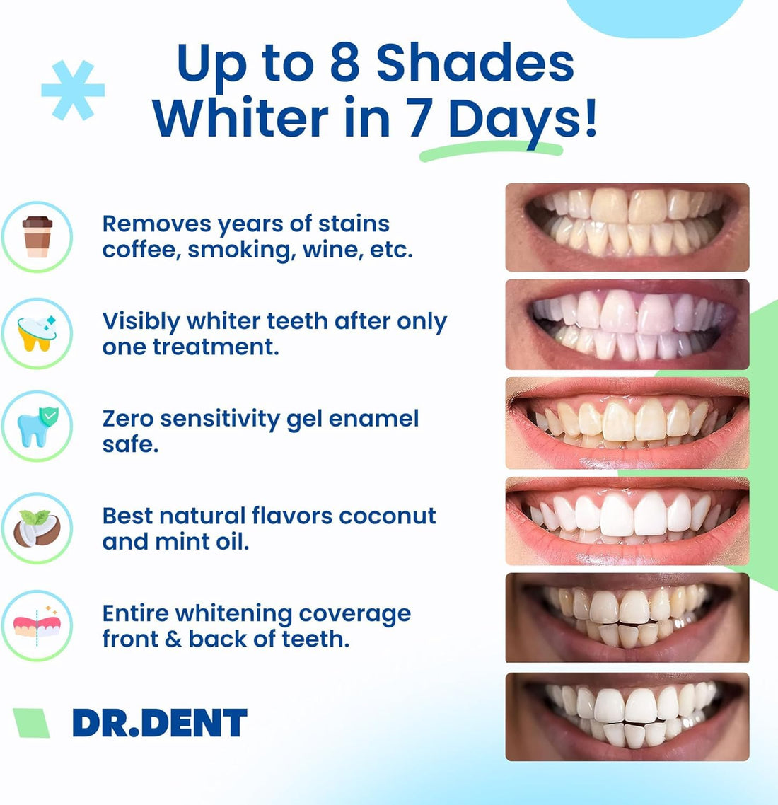 DRDENT Teeth Whitening Strips Professional Strength – 21 Treatments (42 Strips) with Mouth Opener – Enamel Safe Teeth Whitening Kit for Sensitive Teeth