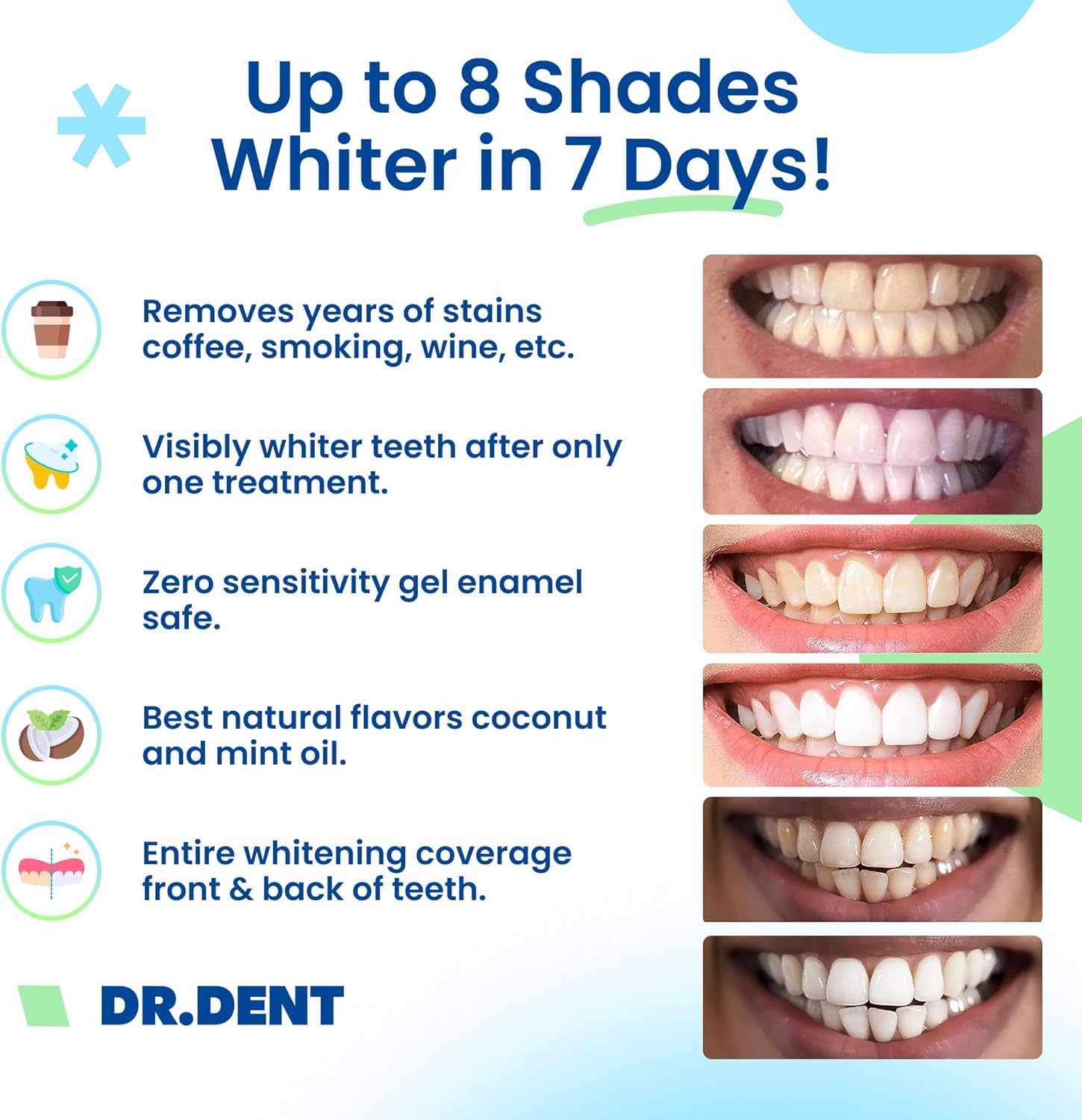 DRDENT Teeth Whitening Strips Professional Strength – 21 Treatments (42 Strips) with Mouth Opener – Enamel Safe Teeth Whitening Kit for Sensitive Teeth