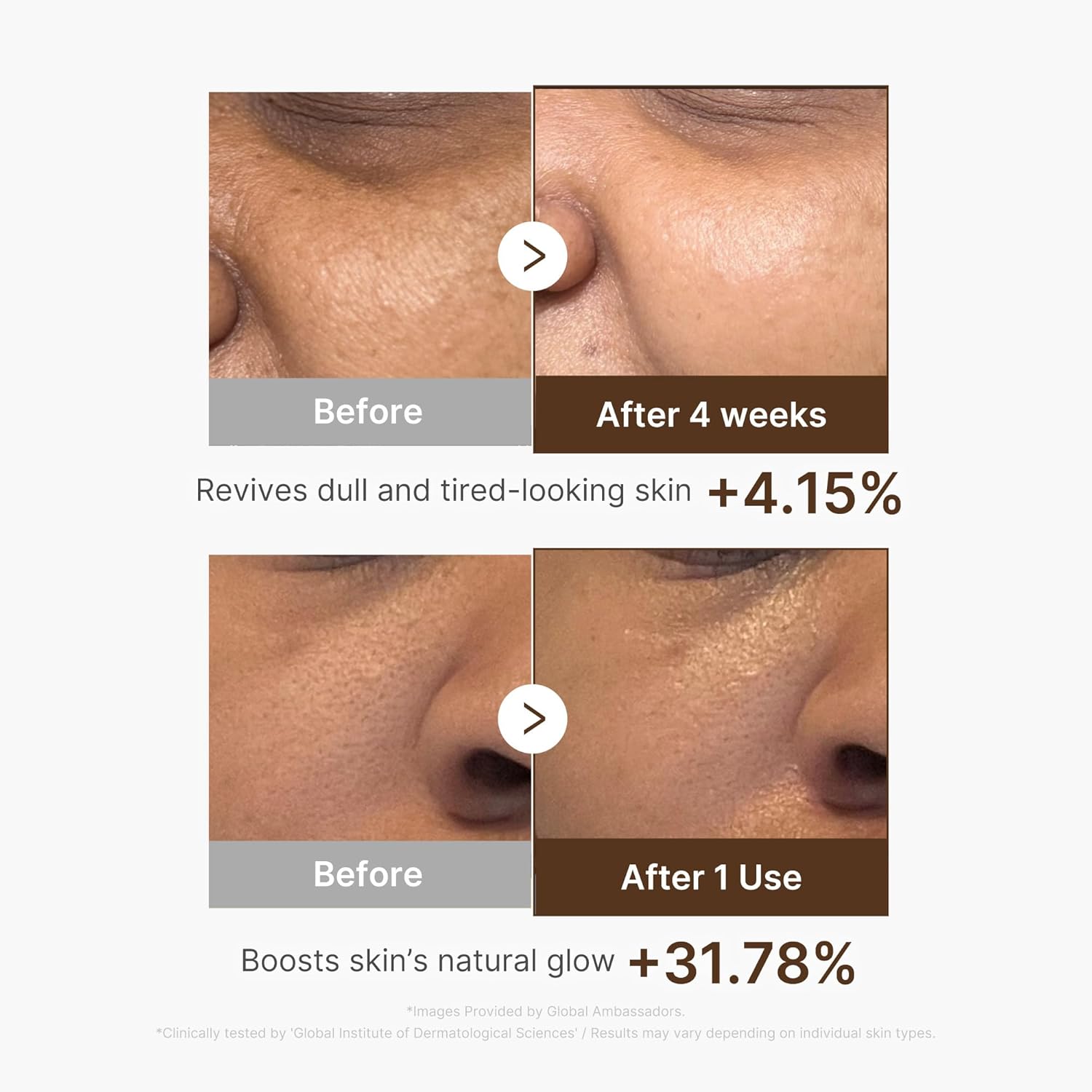 medicube Deep Vitamin C Capsule Serum | Hydrating Vitamin C Serum for Dull & Uneven-Looking Skin with Visible Concerns | Liposome Capsules for Smooth, Radiant Texture | Korean Skincare 1.01 fl.oz Halalzen