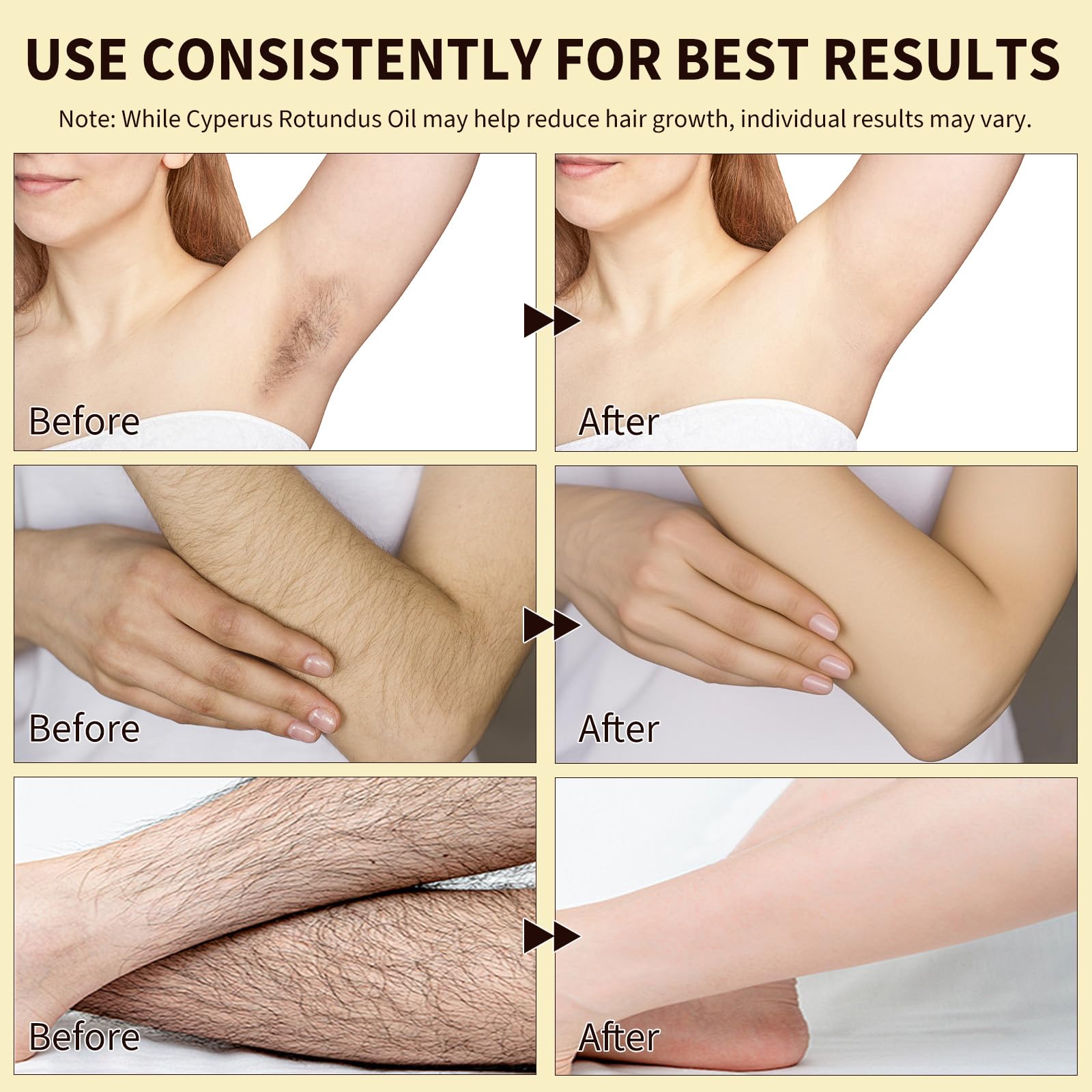 Cyperus Rotundus Oil for Hair Removal, 100% Pure Natural Body and Facial Hair Removal for Women, Reduces Unwanted Hair Growth After Shave, Shrink Pores, Hydrates, Soothes and Repairs Skin