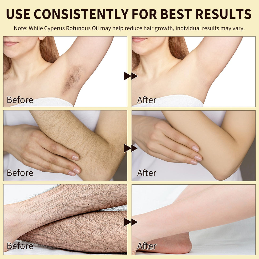 Cyperus Rotundus Oil for Hair Removal, 100% Pure Natural Body and Facial Hair Removal for Women, Reduces Unwanted Hair Growth After Shave, Shrink Pores, Hydrates, Soothes and Repairs Skin