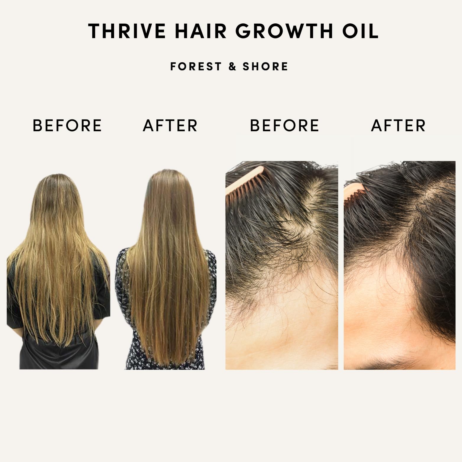 Hair Growth Oil 100% Natural Hair Oil with Caffeine, Biotin, Castor Oil, Argan Oil, Coconut Oil, and Rosemary Oil Effective Thickening Mask & Hair Loss Treatment Halalzen