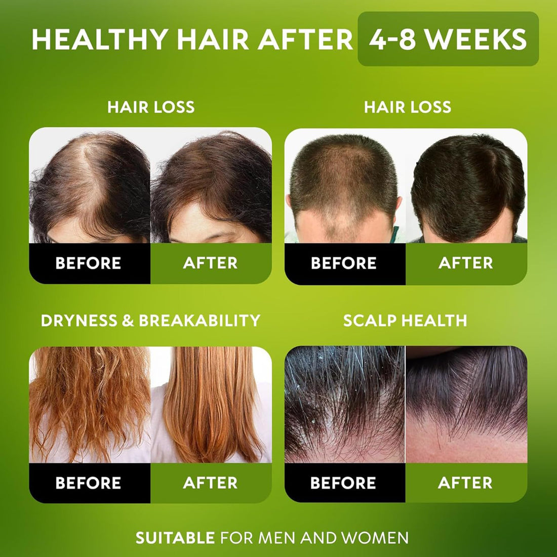 Veganic Hair Oil,100% Natural Growth With Caffeine,Biotin,Coconut,Macadamia,Rosemary and Castor for Growth,Thickening Hair Mask & Loss Treatment,60ml