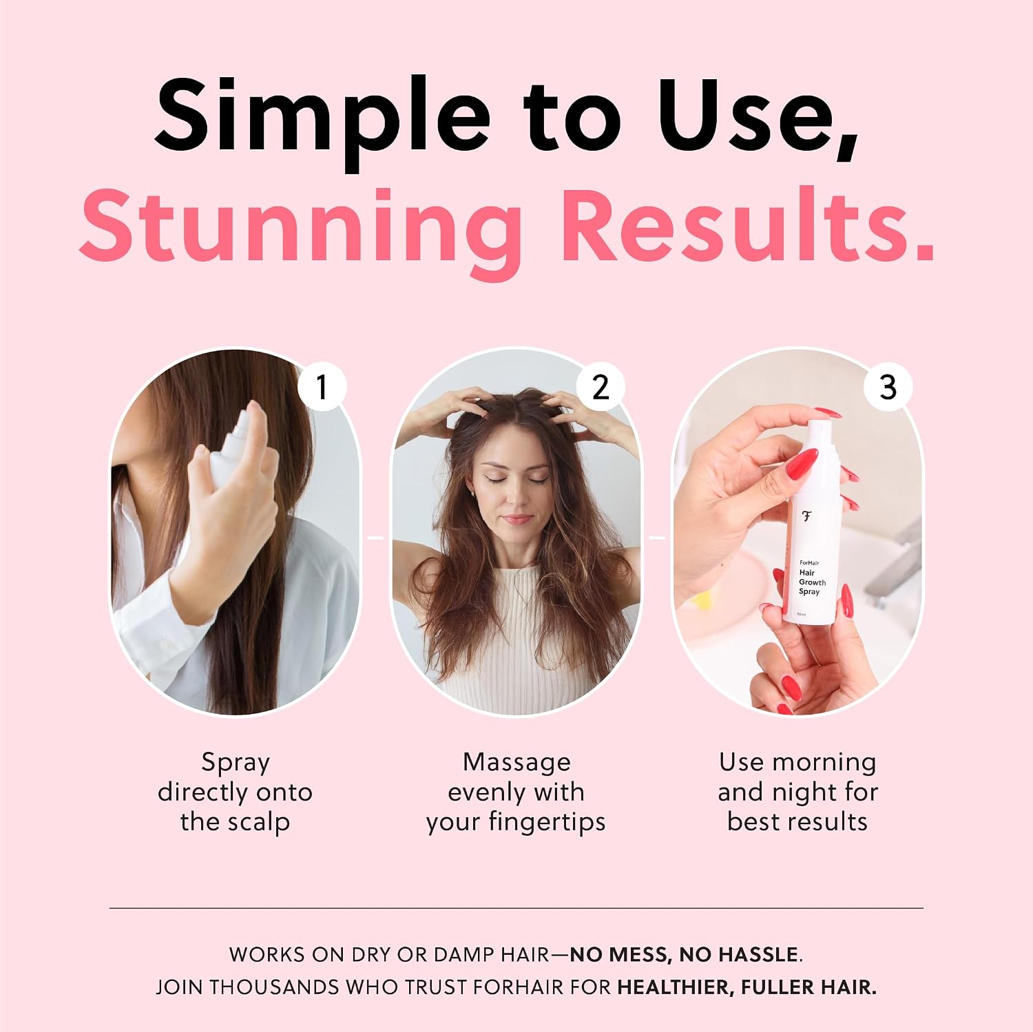 ForChics Hair Growth Serum for Women- Results in 4 Weeks- Hormone Free Hair Regrowth Treatment - For Thinning Hair Loss - Fast Absorbing Non-Greasy Scalp Spray 50ml