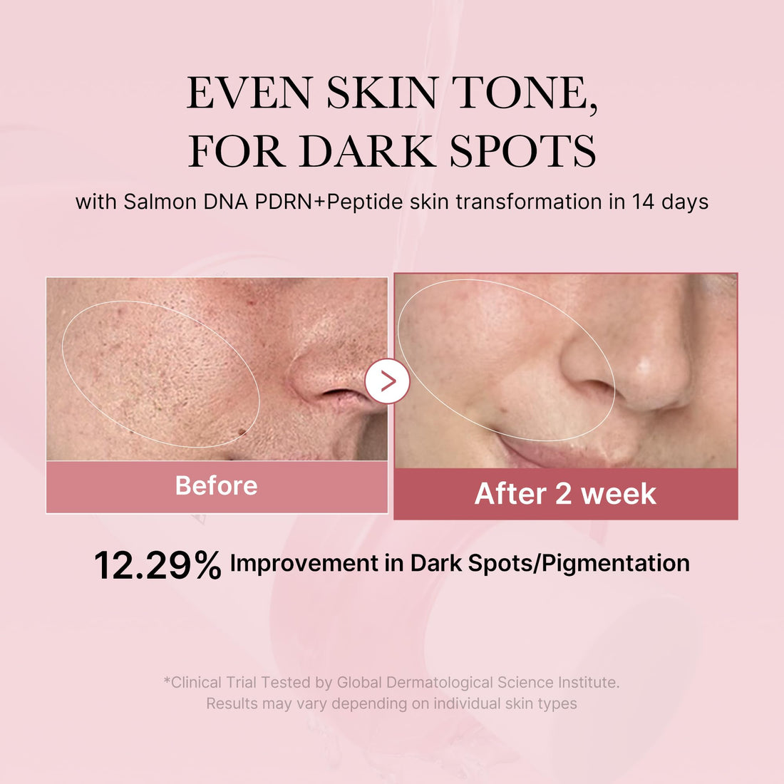 medicube Salmon DNA PDRN Pink CICA Soothing Toner I Pink Glow Toner for Skin Boosting, Soothing and Calming, Uneven Skin Tone, Peptide & Niacinamide, Korean Skin Care (250ml)