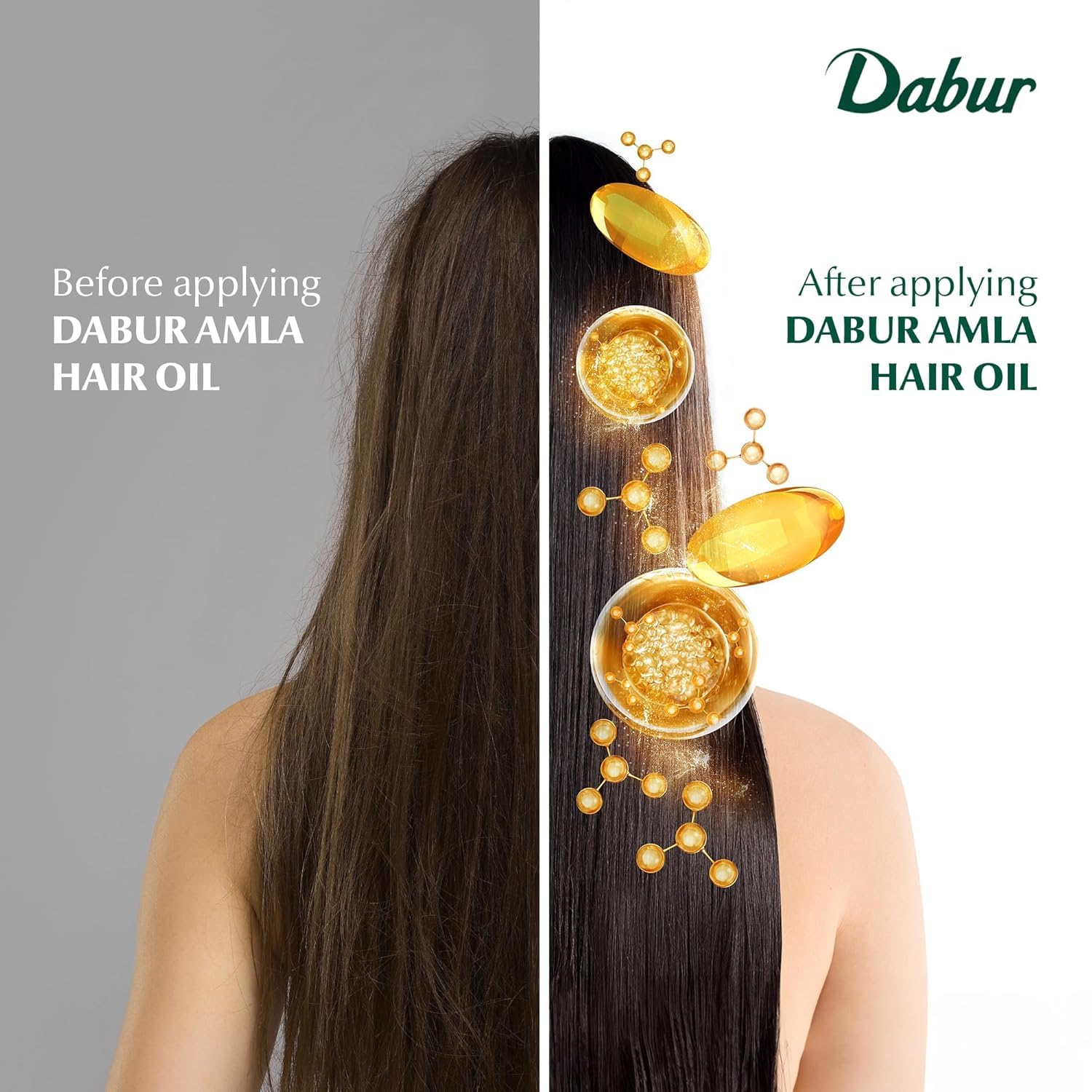 Dabur Amla Hair Oil - 200ml | For Strong, Long and Thick hair | Nourishes Scalp | Controls Hair Fall, Strengthens Hair & Promotes Hair Growth