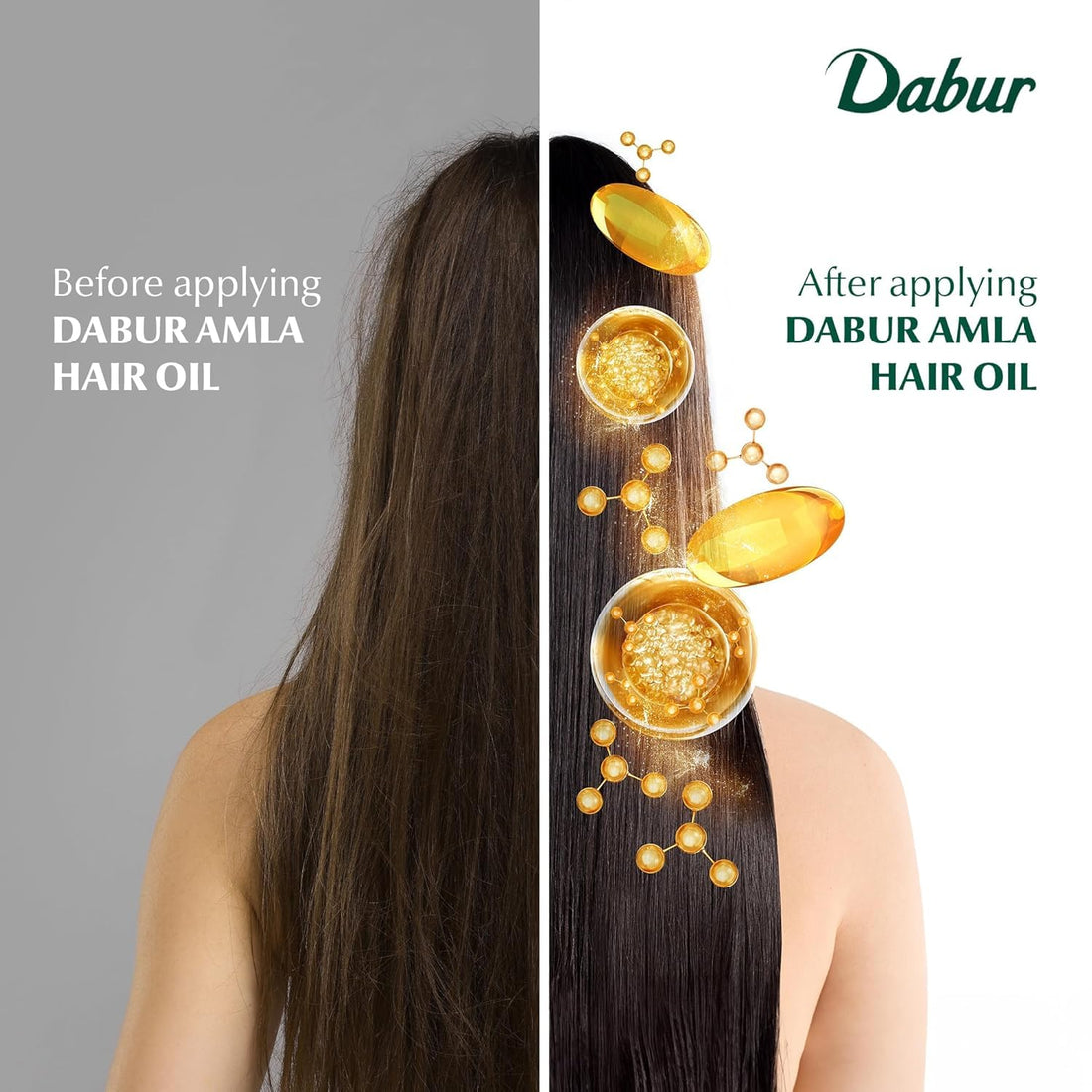 Dabur Amla Hair Oil - 200ml | For Strong, Long and Thick hair | Nourishes Scalp | Controls Hair Fall, Strengthens Hair & Promotes Hair Growth