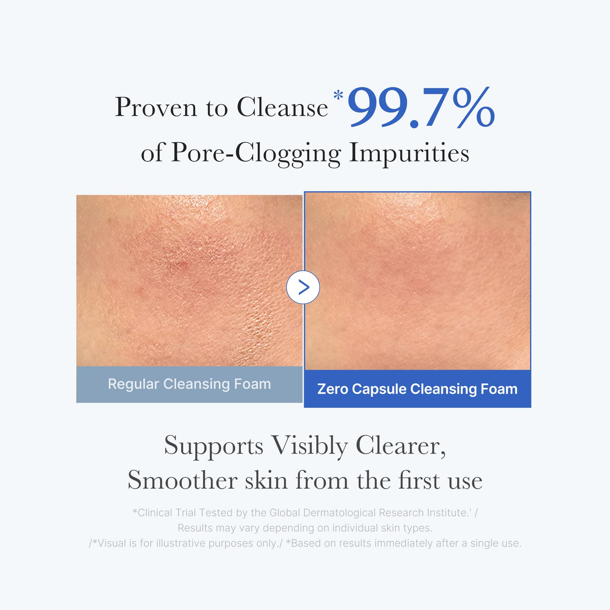 medicube Zero Foam Cleanser for Sensitive Skin - Sebum Control, Moisture Balance, and Pore Minimization | Korean Skincare 120g