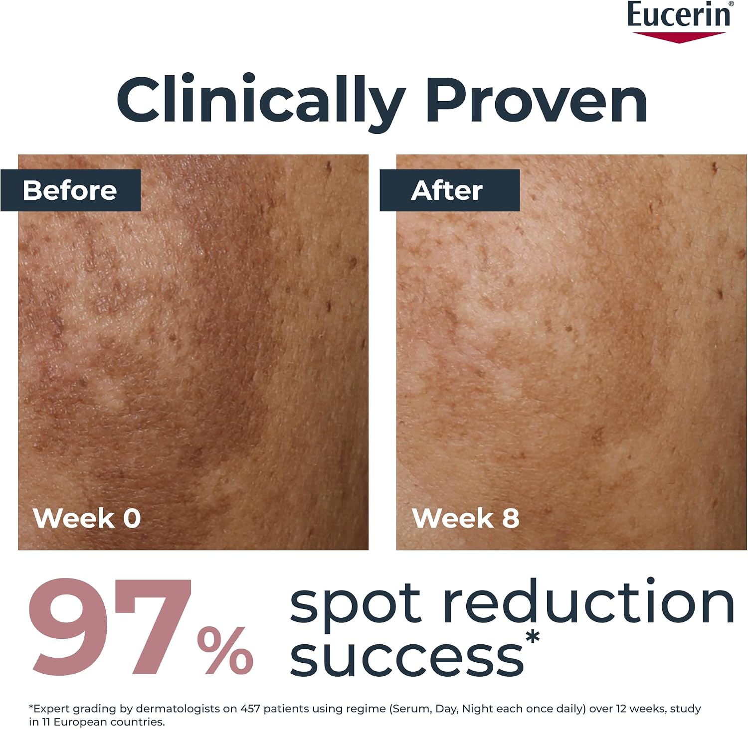 Eucerin Anti-Pigment Dual Face Serum 30ml, Hyperpigmentation Treatment for Age Spots and Uneven Skin Tone, Advanced Anti-Pigment Face Serum for Women with Hyaluronic Acid Halalzen
