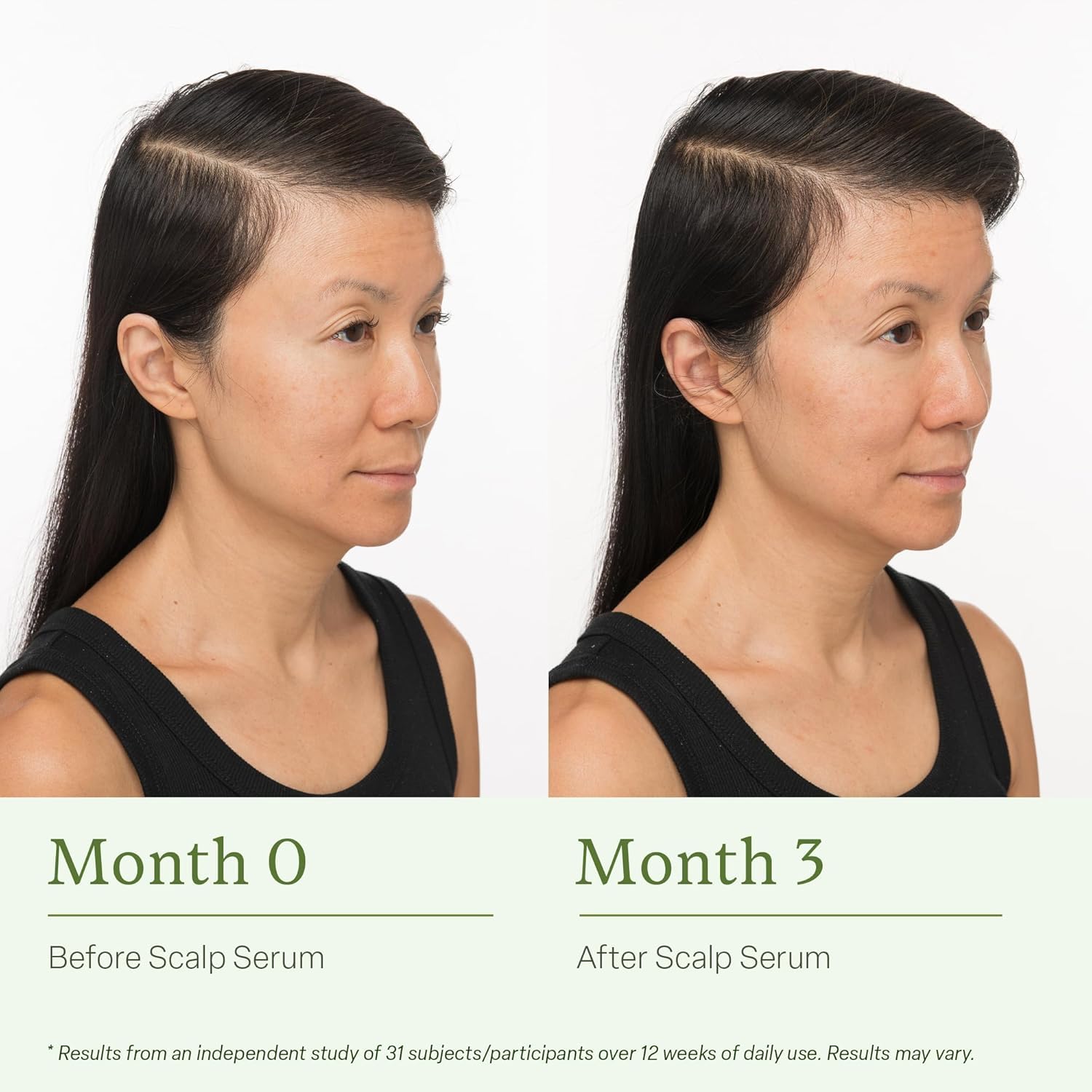 Divi Scalp Serum for Thinning Hair Clinically Tested, Non-Greasy Formula with Amino Acids, Caffeine & Rosemary Oil Promotes Healthy Scalp & Fuller-Looking Hair, Reduces Oil & Product Buildup