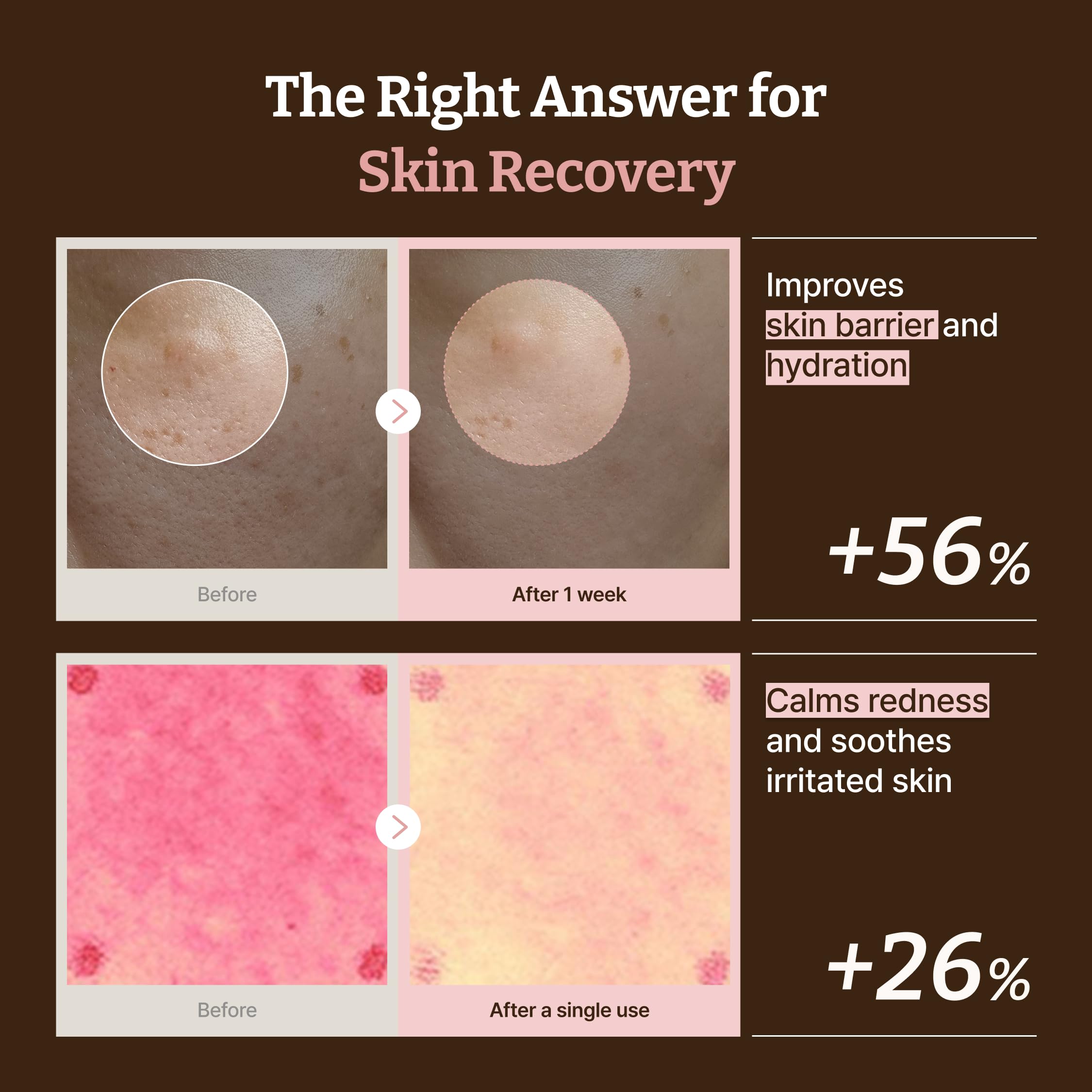 Dr.Reju-All Advanced PDRN Rejuvenating Cream – 99% Pure Salmon DNA Gel Type Face Moisturizer – Optimal 1200ppm for Glass Skin & Plumping – Korean Pharmacy Anti-Aging Skin Care Face Cream – 20ml