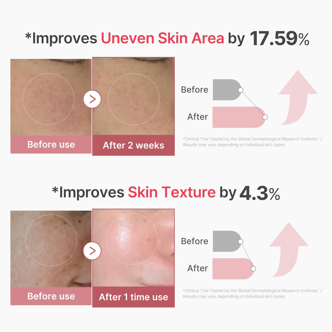 medicube Exosome Shot Zero 2,000 PPM Spicule Facial Serum | Liquid Skin Booster Serum | Exosome, AHA+BHA+PHA | Pore Care, Dead Skin Cells, Skin Texture | Korean Skincare, 1.01 fl.oz Halalzen