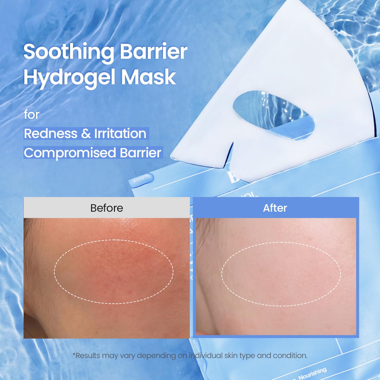 BIODANCE Caviar PDRN Real Deep Hydrogel Mask 4 Pcs | Hydrogel Overiight Mask | Skin Firming, Radiance, Enhancing Skin Recovery | Korean Face Mask for Glass Skin | Korean Skincare