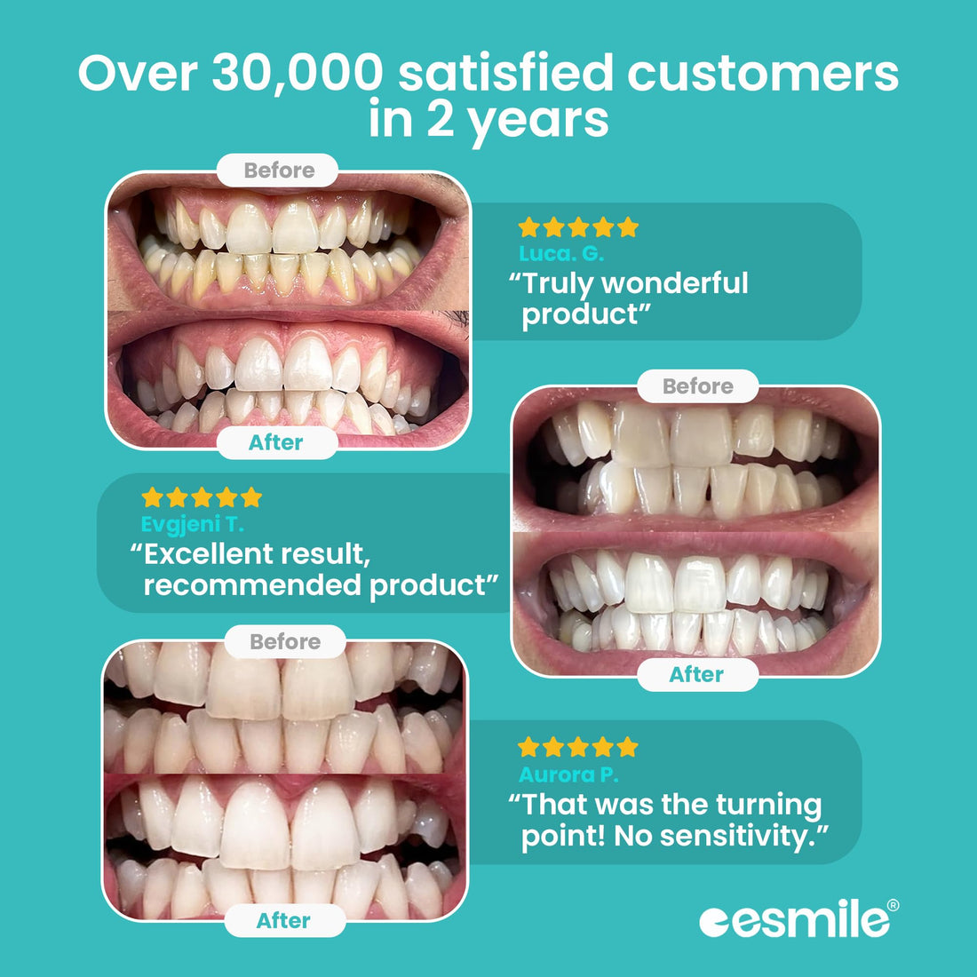 ESMILE Teeth Whitening Kit with 16 LED Light – Professional Home Whitening System for Sensitive Teeth – Fast Stain Removal, Enamel Safe, Includes Whitening Gel
