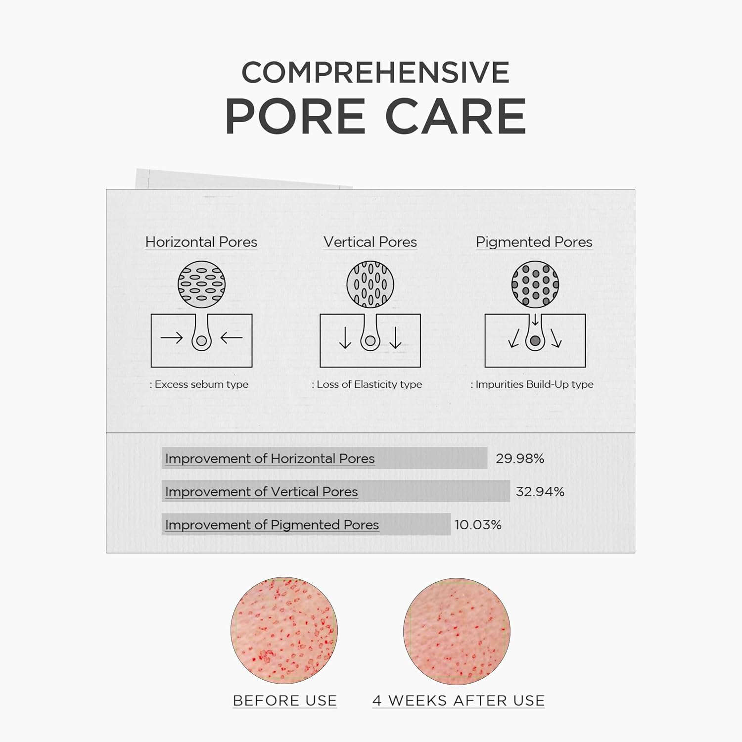 SKIN1004 Madagascar Centella Niacinamide 10 Boosting Shot Ampoule, 30 ml
