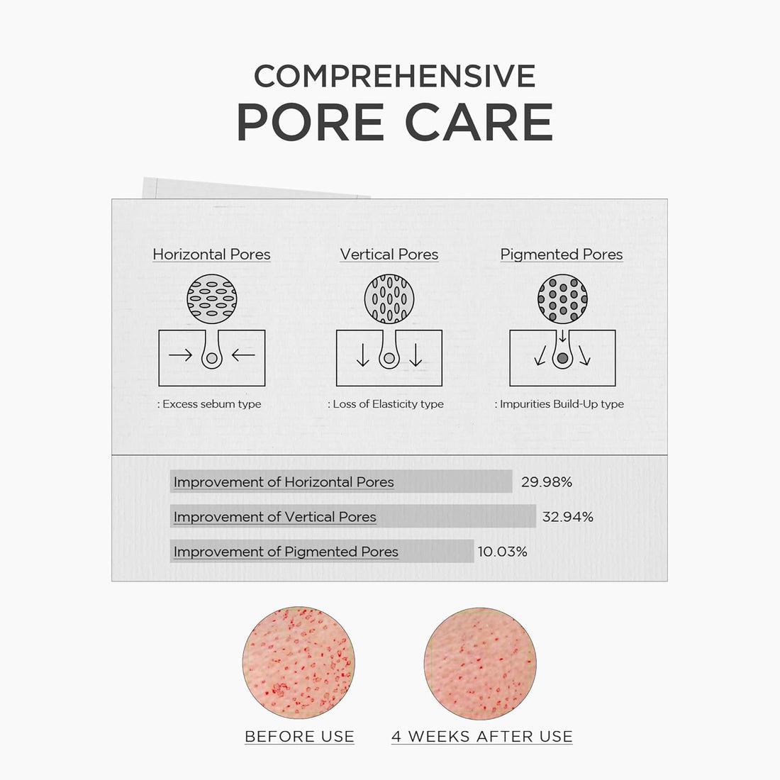 SKIN1004 Madagascar Centella Niacinamide 10 Boosting Shot Ampoule, 30 ml