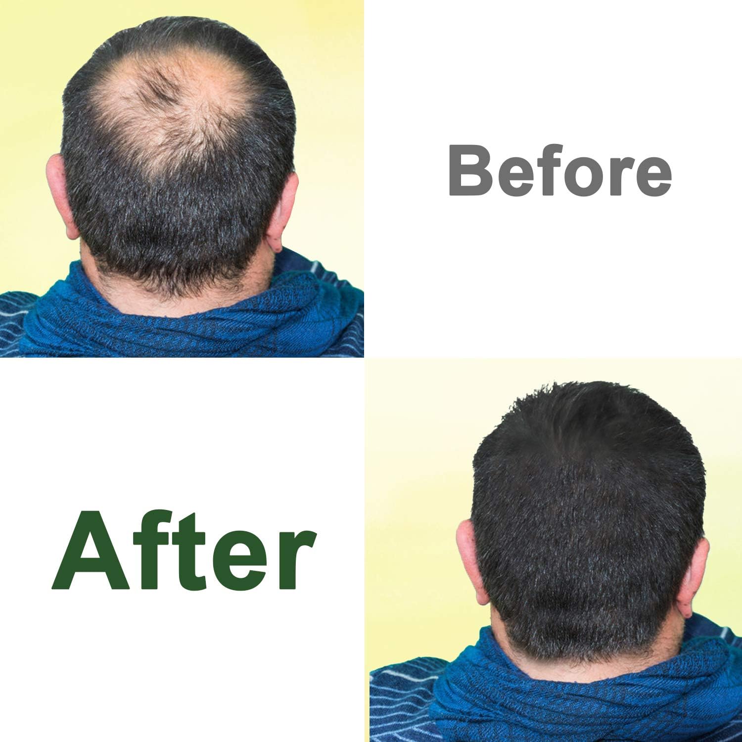 Rosemary Oil for Hair Growth,2x120ml Diluted Rosemary Oil and Hair Serum for Dry Damaged Hair,Proven Hair Loss Treatment & Hair Thickening Products