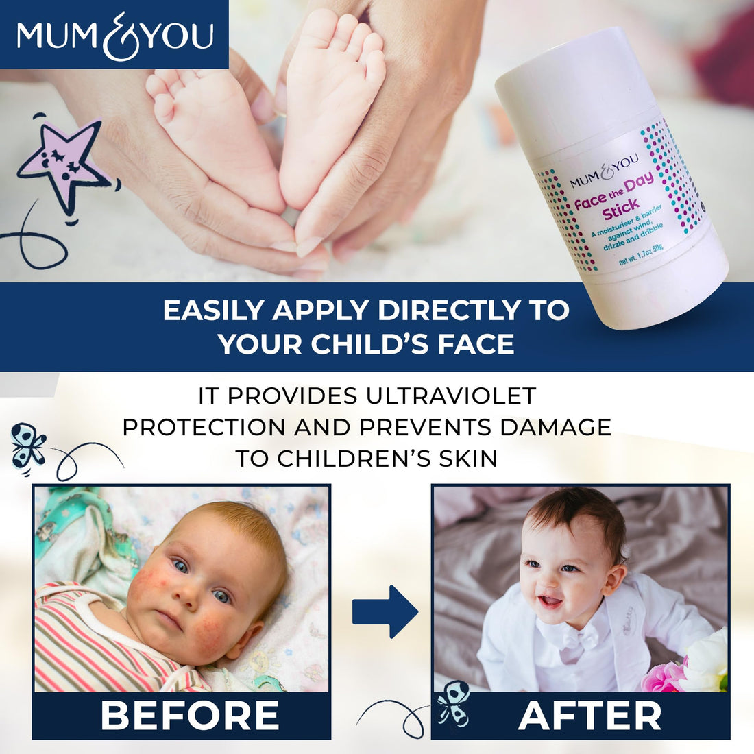 Mum & You Baby Face the Day Stick – Natural baby Moisturiser with Sunflower, Coconut Oil & Shea Butter, Soothes Eczema, Teething Protection, Dribble Rash & Protects Skin in Winter, Cold & Dry Weather