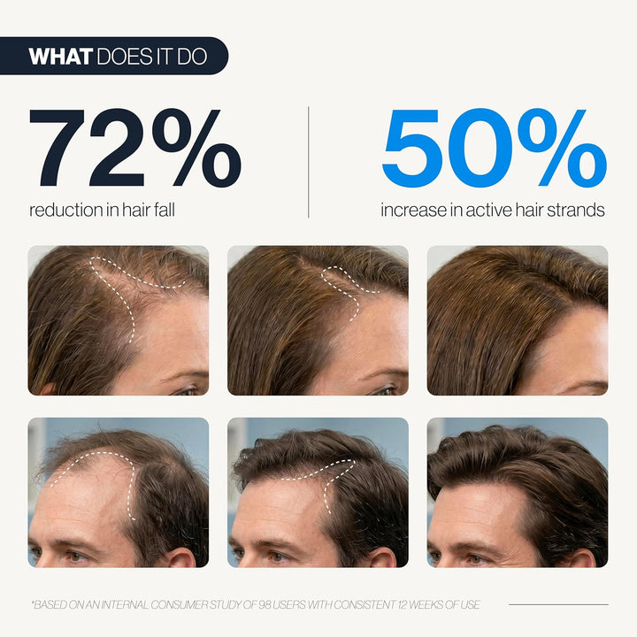 Be Bodywise Hair Growth Serum Roll On - 5% Saw Palmetto, 3% Rosemary Oil for Hair Growth, 3% Fenugreek,1% Caffeine Herbasome | Serum for Hair Loss & Hair Regrowth For Men & Women 25ml/0.84 fl oz Halalzen