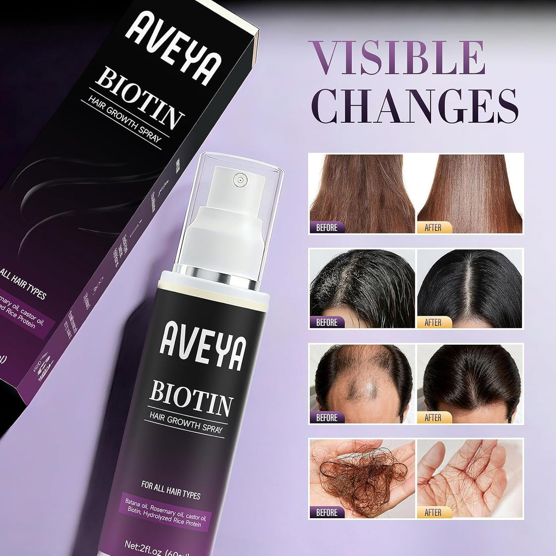 AVEYA Hair Growth Serum, for Women & Men infused with Rosemary Oil,Batana Oil&Biotin for Scalp – Strengthens,Thickens&Accelerates Hair Care - Non-Greasy,Helps Prevent Hair Thinning & Hair Loss – 60ml