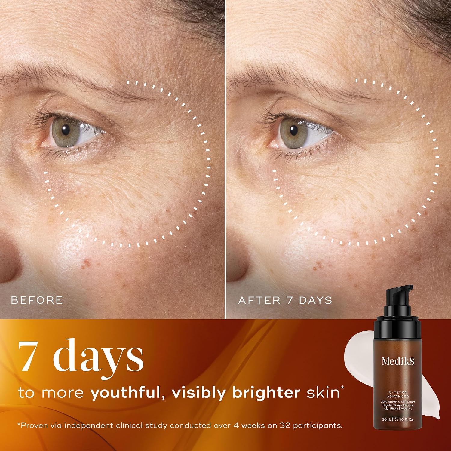 Medik8 C-Tetra Advanced - 20% Vitamin C Gel-Serum With Exosomes - Defend Against Premature Skin Ageing & Achieve Accelerated Skin Brightening