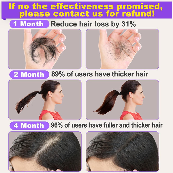 Rosemary Oil for Hair Growth,Diluted Rosemary Oil with Sclap Massager&Ebook,Hair Growth Oil Serum with Castor Oil Biotin Argan for Dry Damaged Hair,Hair Ingrown Loss Treatments for Women Men Halalzen