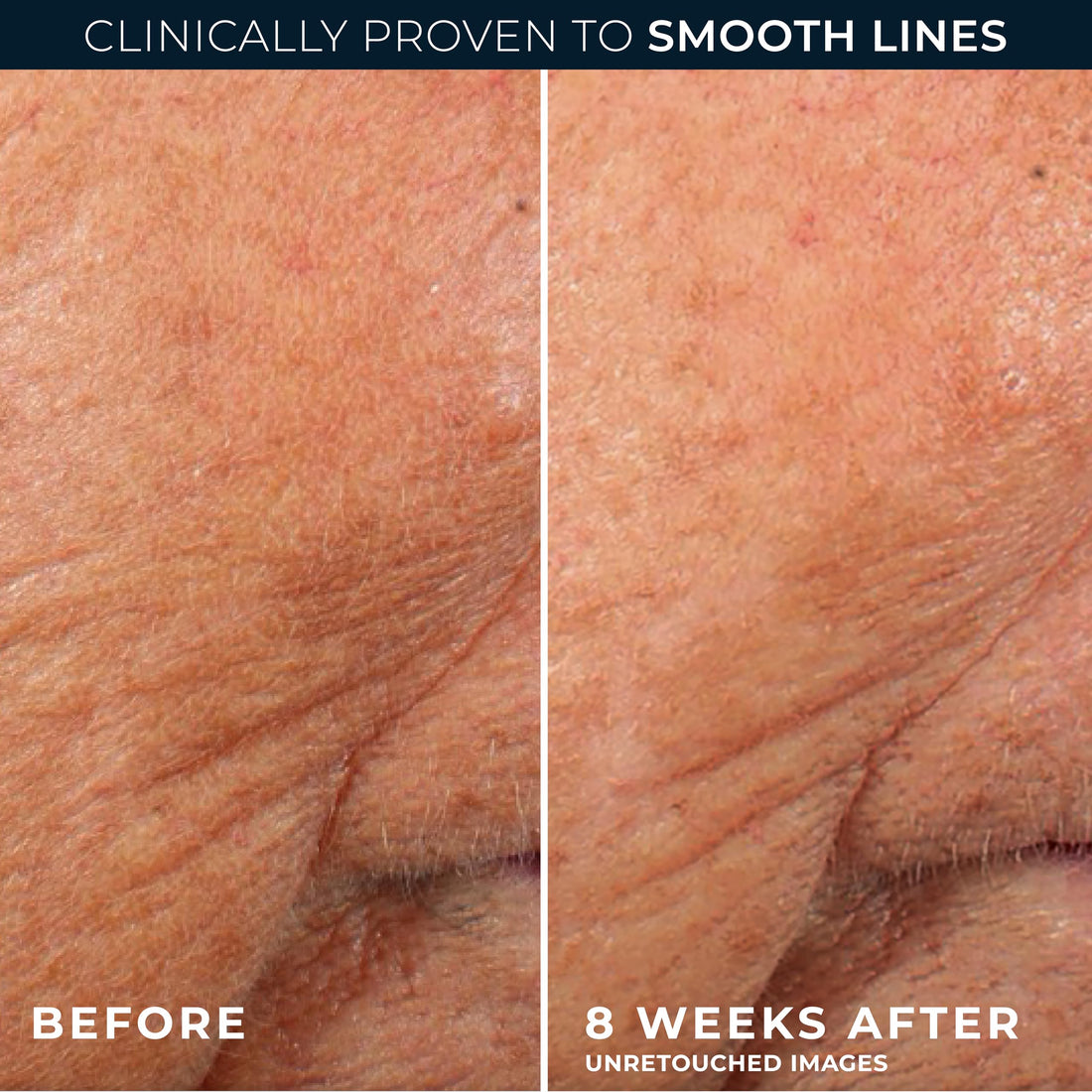 RoC Retinol Correxion Line Smoothing Eye Cream | For Wrinkles, Dark Circles & Puffy Eyes | 15 ml