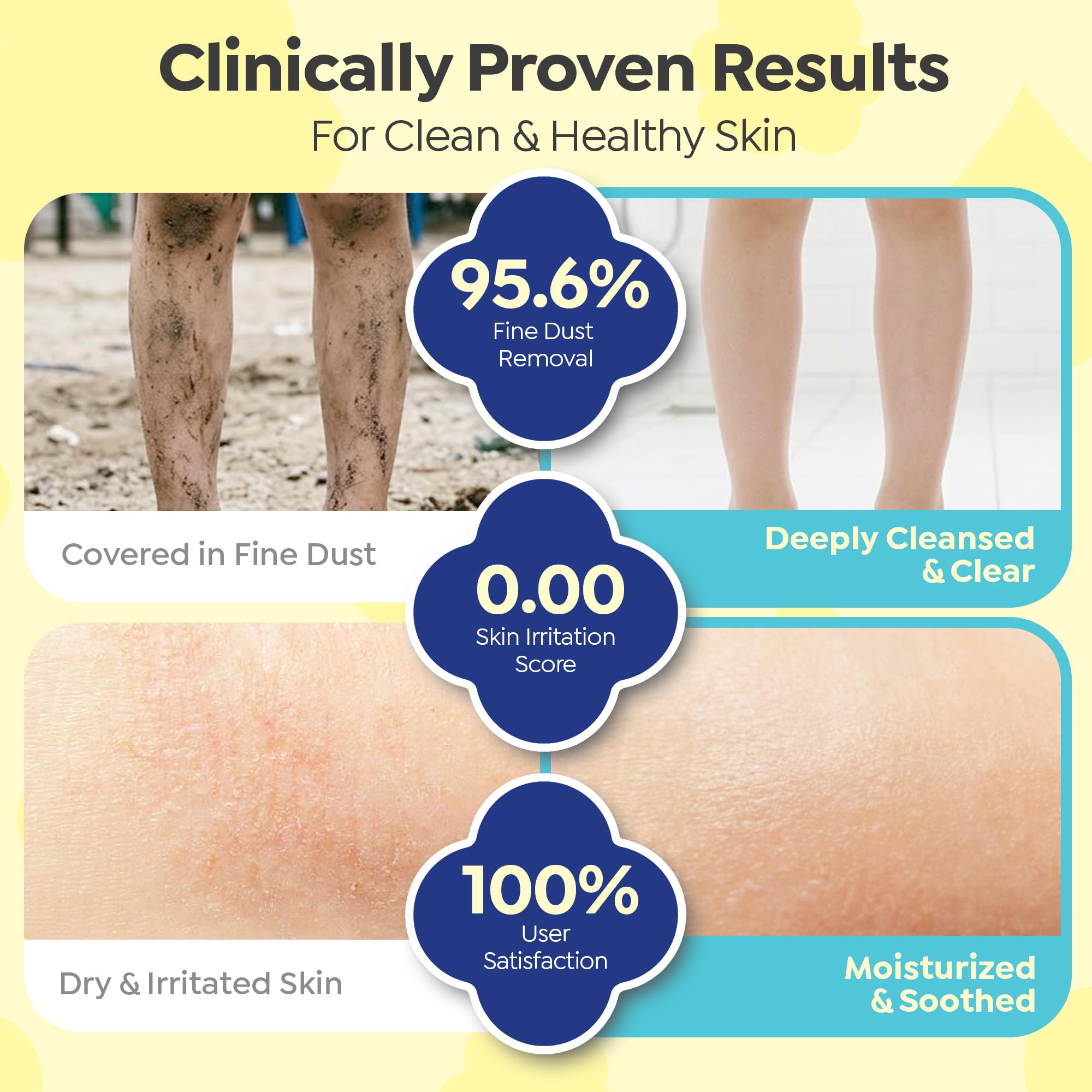 GOONGBE Kids Moisture Body Lotion – 24hr Hydrating Daily Moisturizer for Dry Sensitive Skin – Triple Lipid Complex (Ceramide, Squalane, Cica) – Fast-Absorb Non-Sticky, Allergen-Free 8.45oz