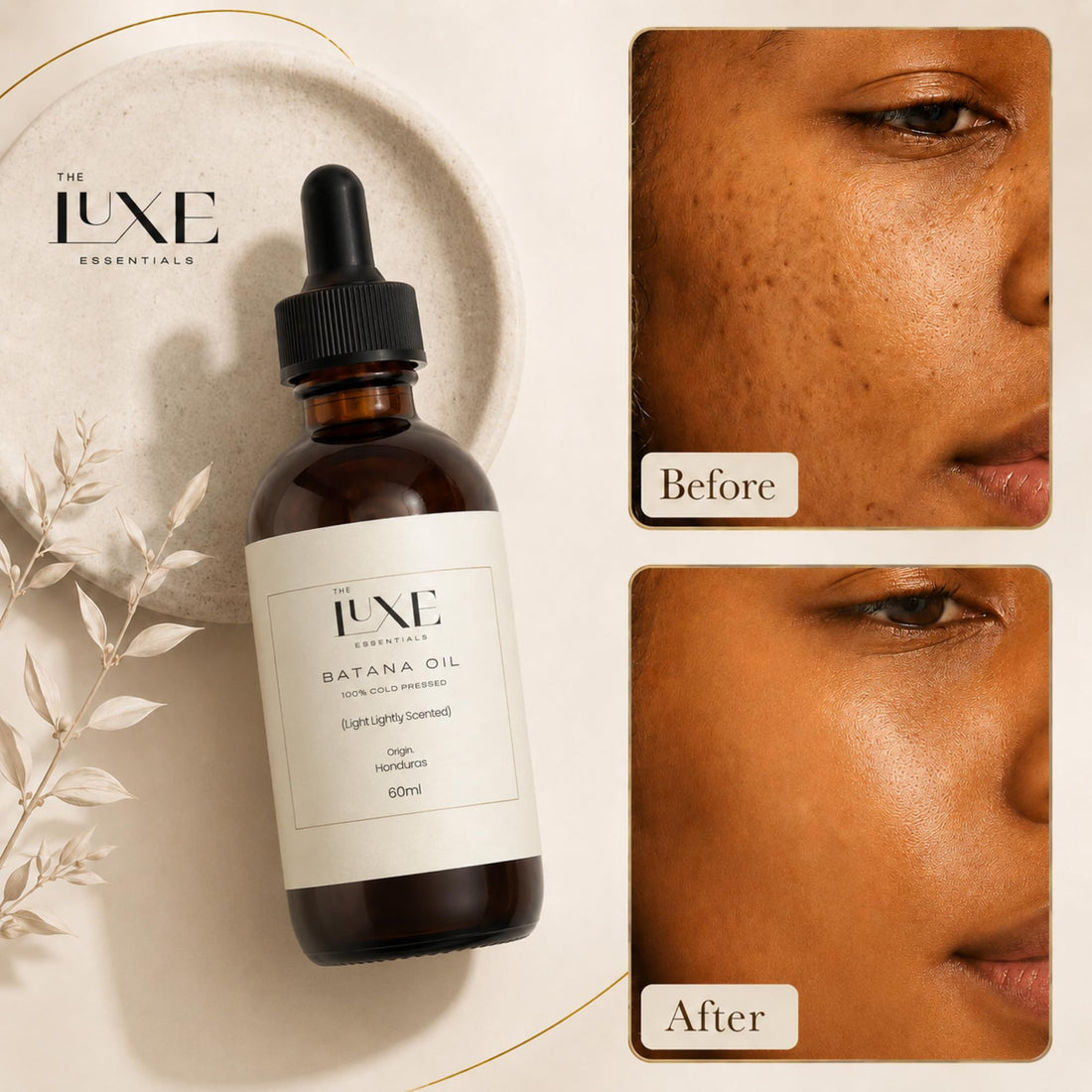 Cold Pressed Batana Oil for Hair Growth | Pure & Unrefined Natural Hair Oil, Beard & Skin Oil | Lightweight, Fast-Absorbing Moisturiser | Raw, Organic & Ethically Sourced (60 ML, Light Scented)