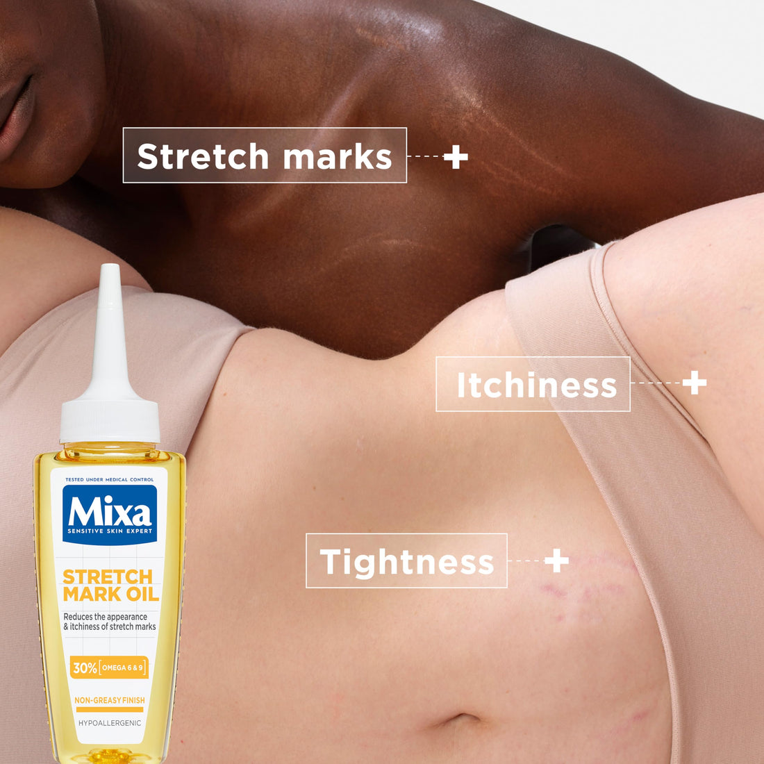 Mixa Cream, Niacinamide Bright Moisturizing Anti-Dark Spot Cream, Body Care Dark Spot Corrector for Uneven Tone, with 9% Niacinamide, Shea Butter & Vitamin C, 400ml