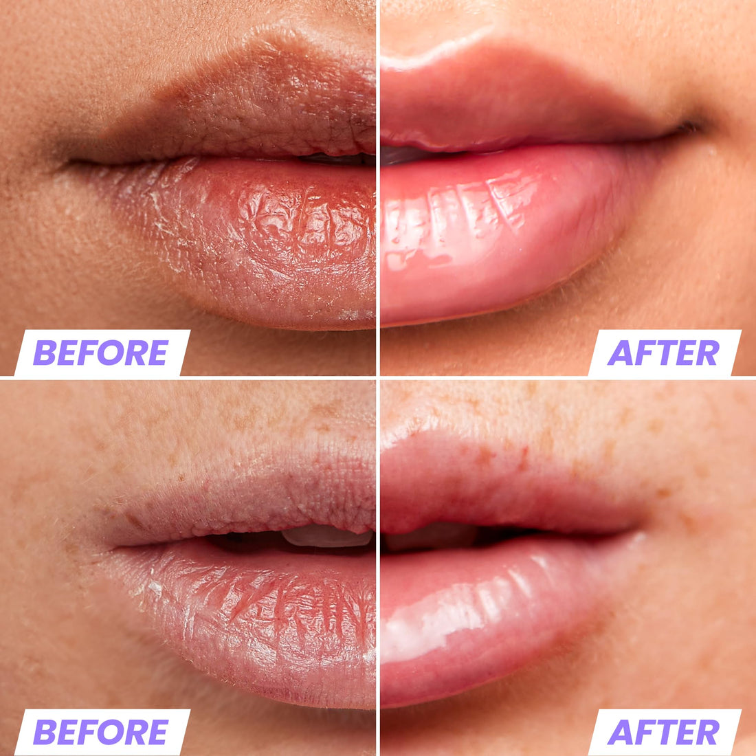 Wonderskin Lip Oil Rehab Serum - Color Changing Lip Oil from Clear to Pink - PH-activated, Non-sticky & Hydrating Tinted Serum for Dry Lips (Kissed)