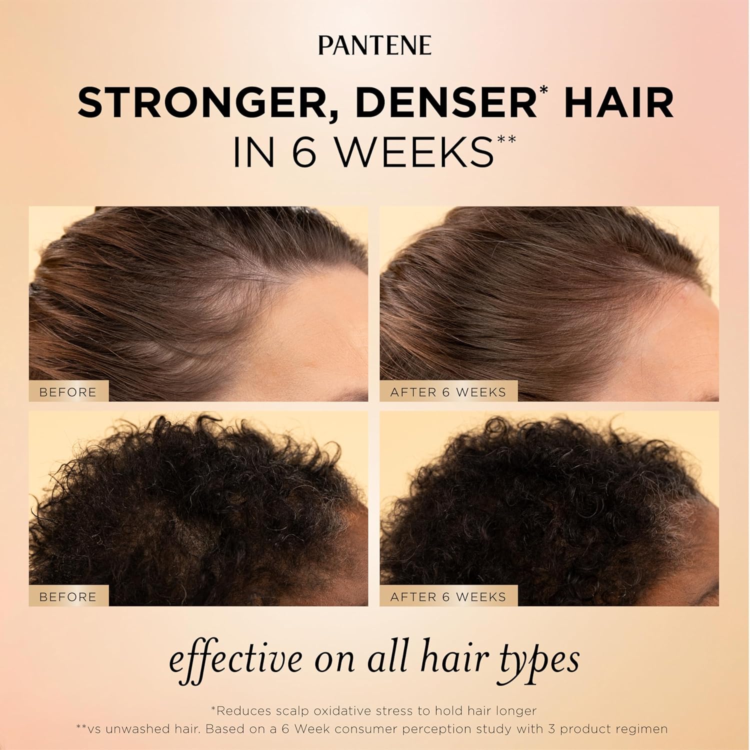 Pantene Abundant & Strong Daily Scalp Serum, Strengthens Scalp’s Hold on Roots, 2 oz Halalzen