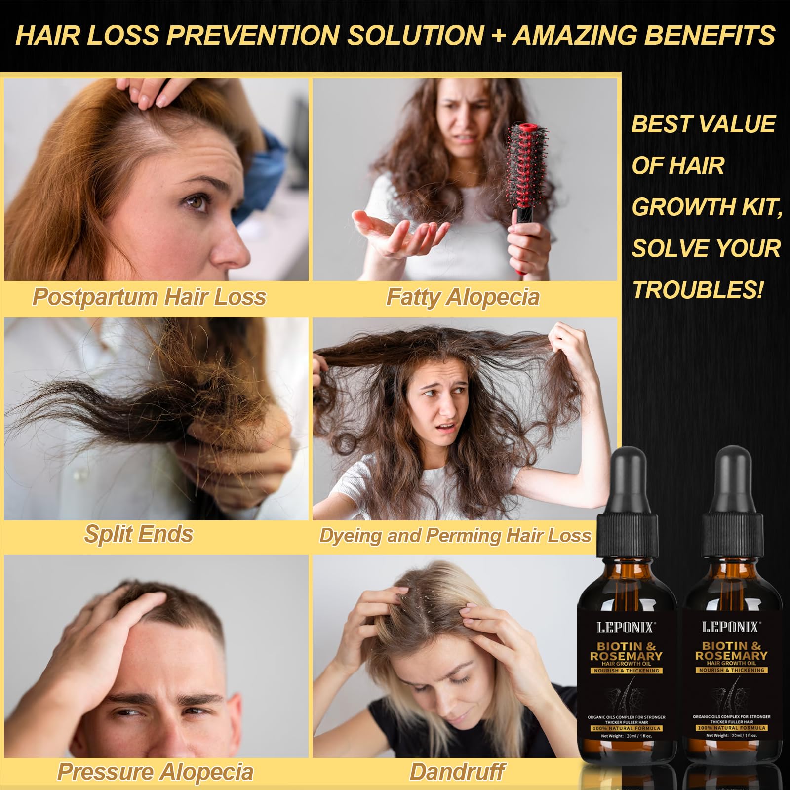 Rosemary Oil for Hair Growth, Diluted Rosemary Oil Hair Growth Serum with Derma Roller & Scalp Massager Hair Thickening Products Hair Loss Treatment for Men Women, Mens Gift Set