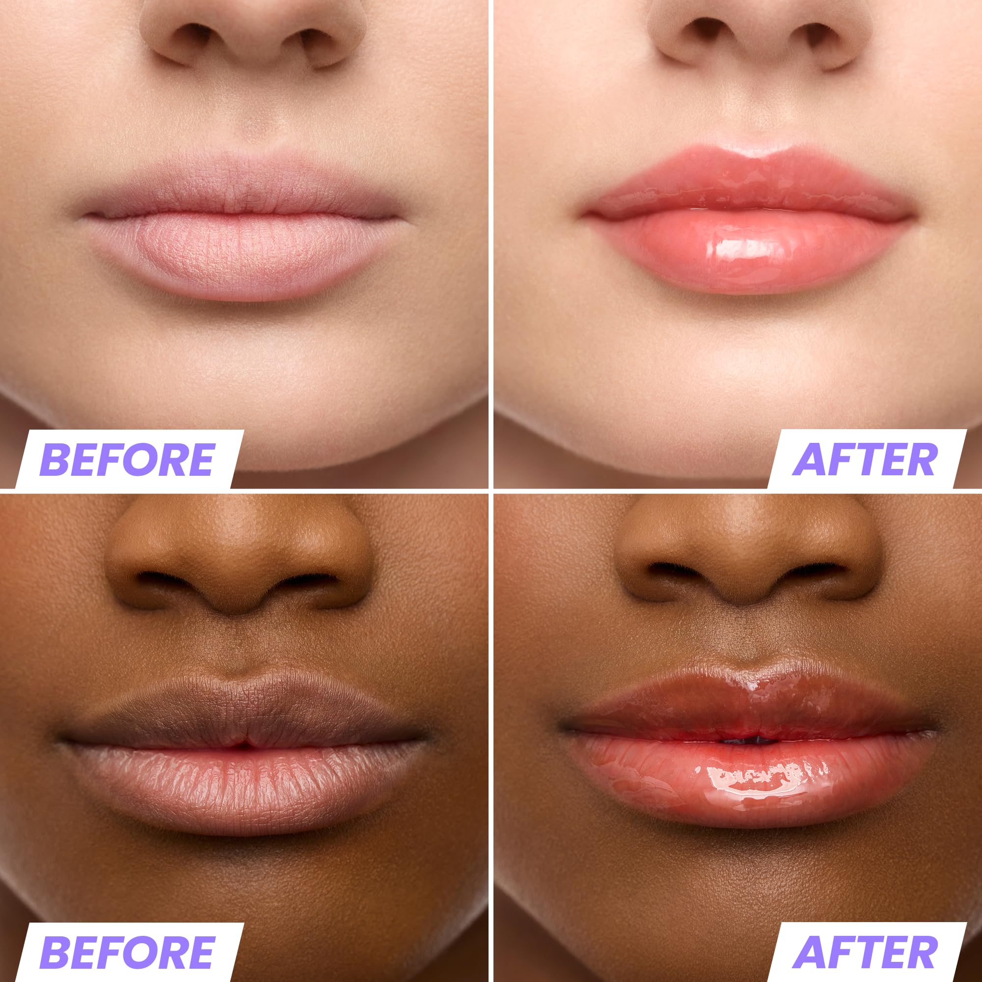 Wonderskin Lip Oil Rehab Serum - Tinted Lip Oil, Hydrating, Moisturizing, and Non-Sticky Deep Red Tint Serum for Dry Lips (Honey) Halalzen