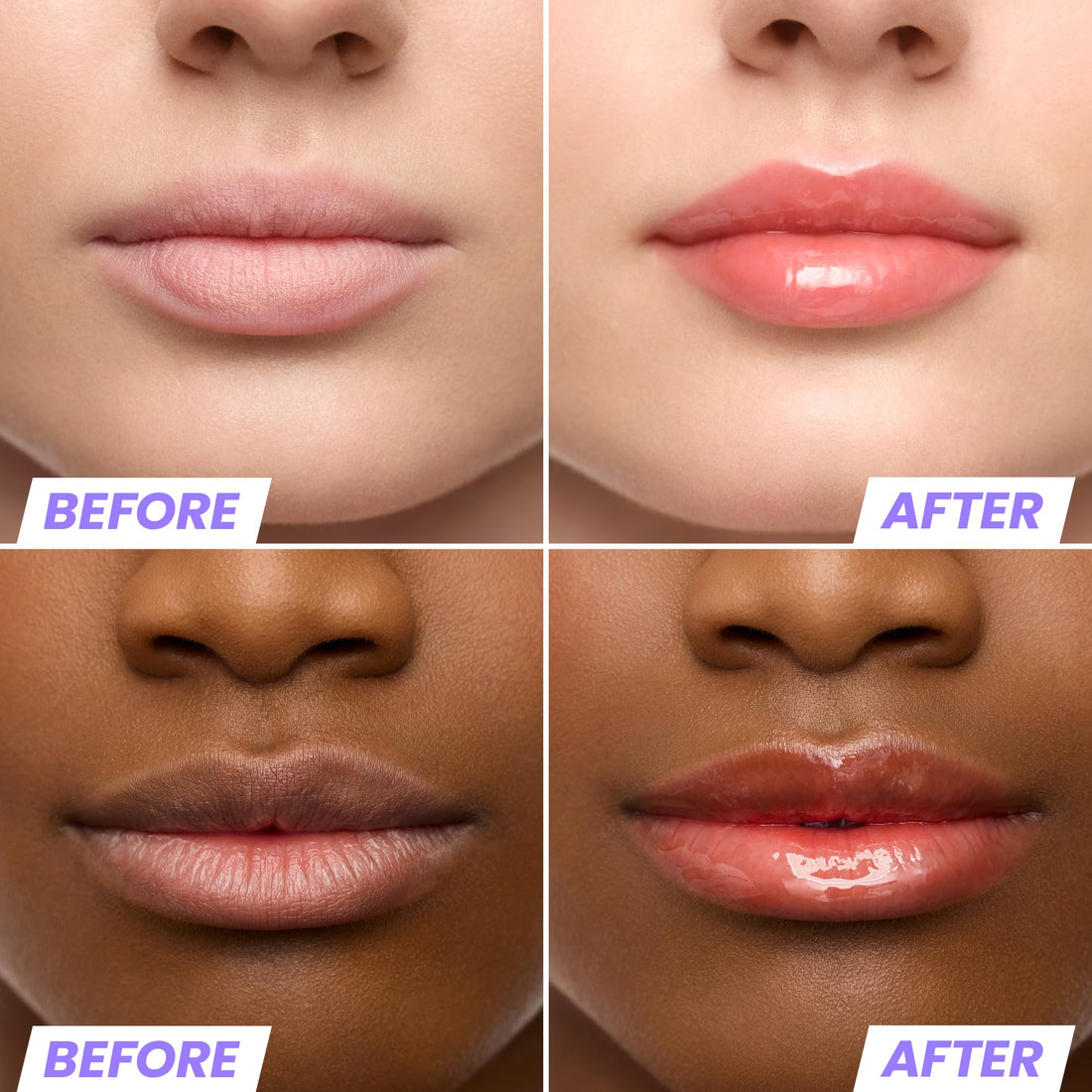 Wonderskin Lip Oil Rehab Serum - Tinted Lip Oil, Hydrating, Moisturizing, and Non-Sticky Deep Red Tint Serum for Dry Lips (Honey) Halalzen