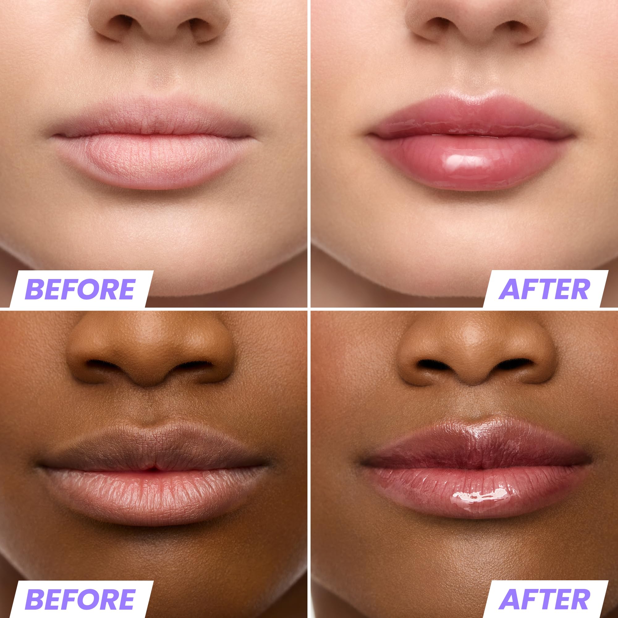 Wonderskin Lip Oil Rehab Serum - Color Changing Lip Oil from Clear to Pink - PH-activated, Non-sticky & Hydrating Tinted Serum for Dry Lips (Kissed)
