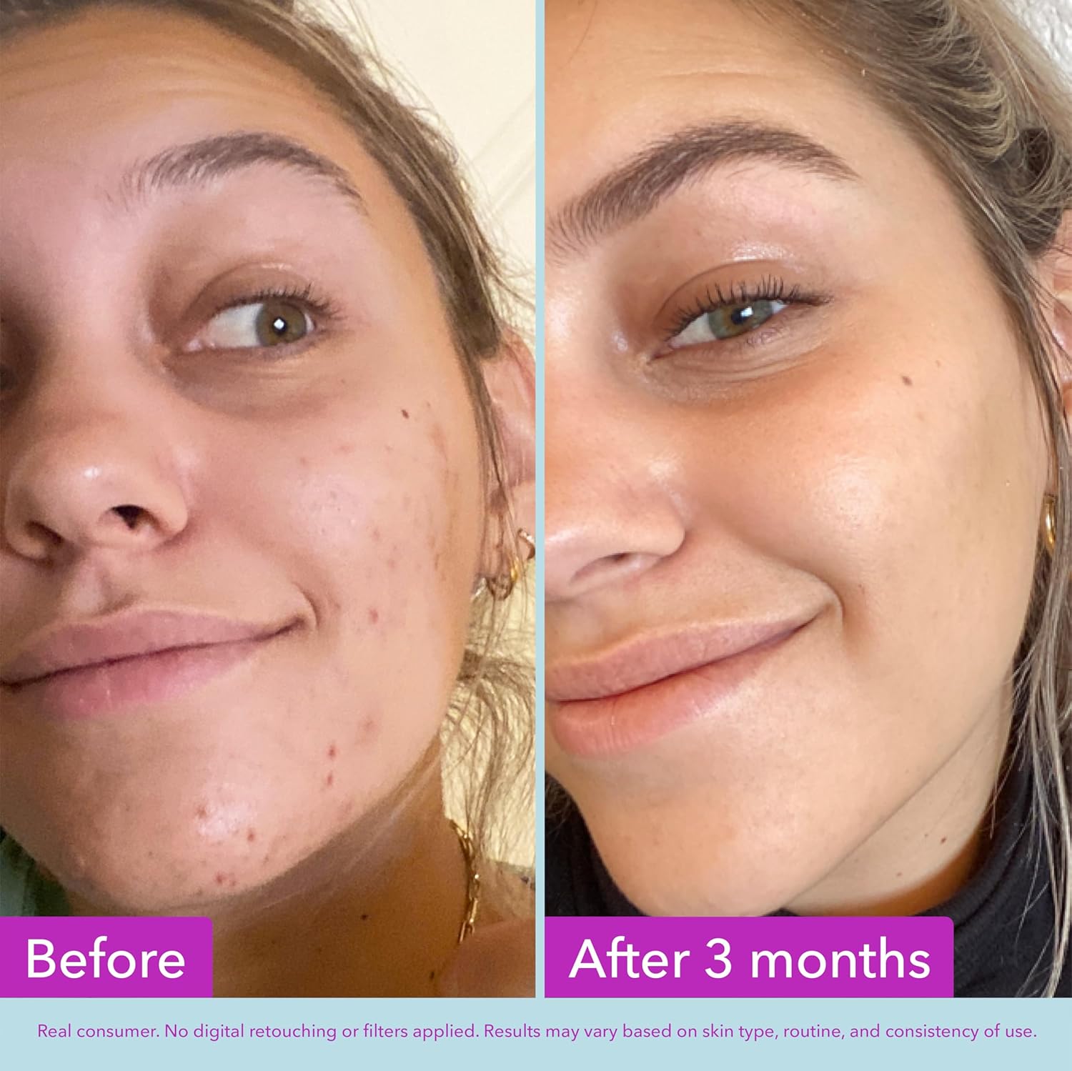 Good Molecules Niacinamide Brightening Toner Facial Toner with Niacinamide, Vitamin C and Arbutin for Even Tone, Enlarged Pores Skincare for Face
