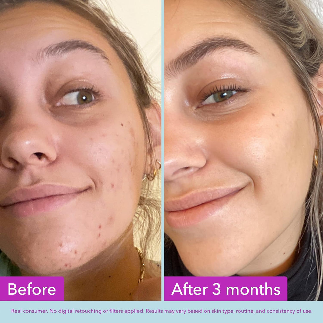 Good Molecules Niacinamide Brightening Toner Facial Toner with Niacinamide, Vitamin C and Arbutin for Even Tone, Enlarged Pores Skincare for Face