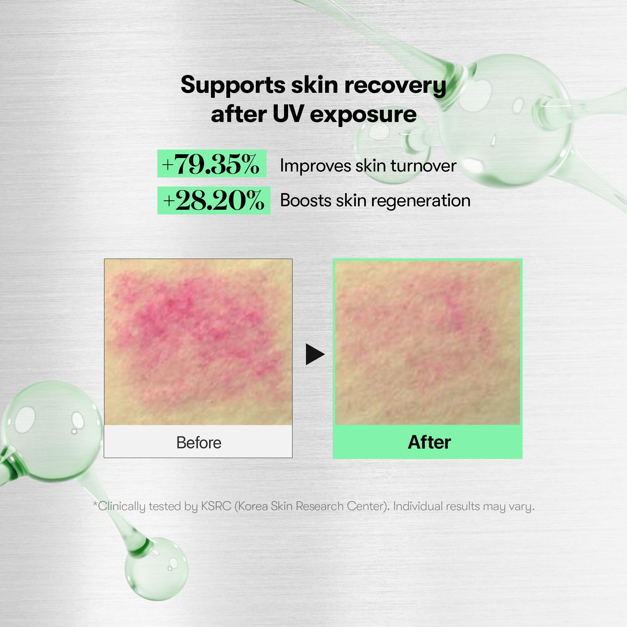 VT COSMETICS CICA Reedle Shot 300, Spicule Microneedling Serum for Pore Care & Exfoliation, Exosome & Centella Asiatica for Glass Skin, Smooth Skin Texture, Korean Skin Booster (1.69 Fl Oz / 50ml) Halalzen