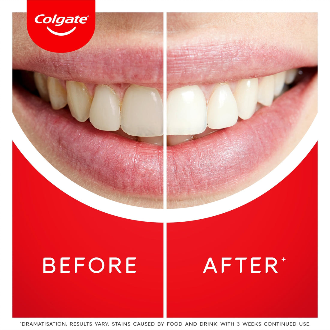 Colgate Max White Ultra+ Enamel Toothpaste 75ml, Whitens Deep Stains for 5X Whiter Teeth, ActiveShine Technology Smoothes Enamel Surface to Reflect Light, Protects and Remineralises Enamel