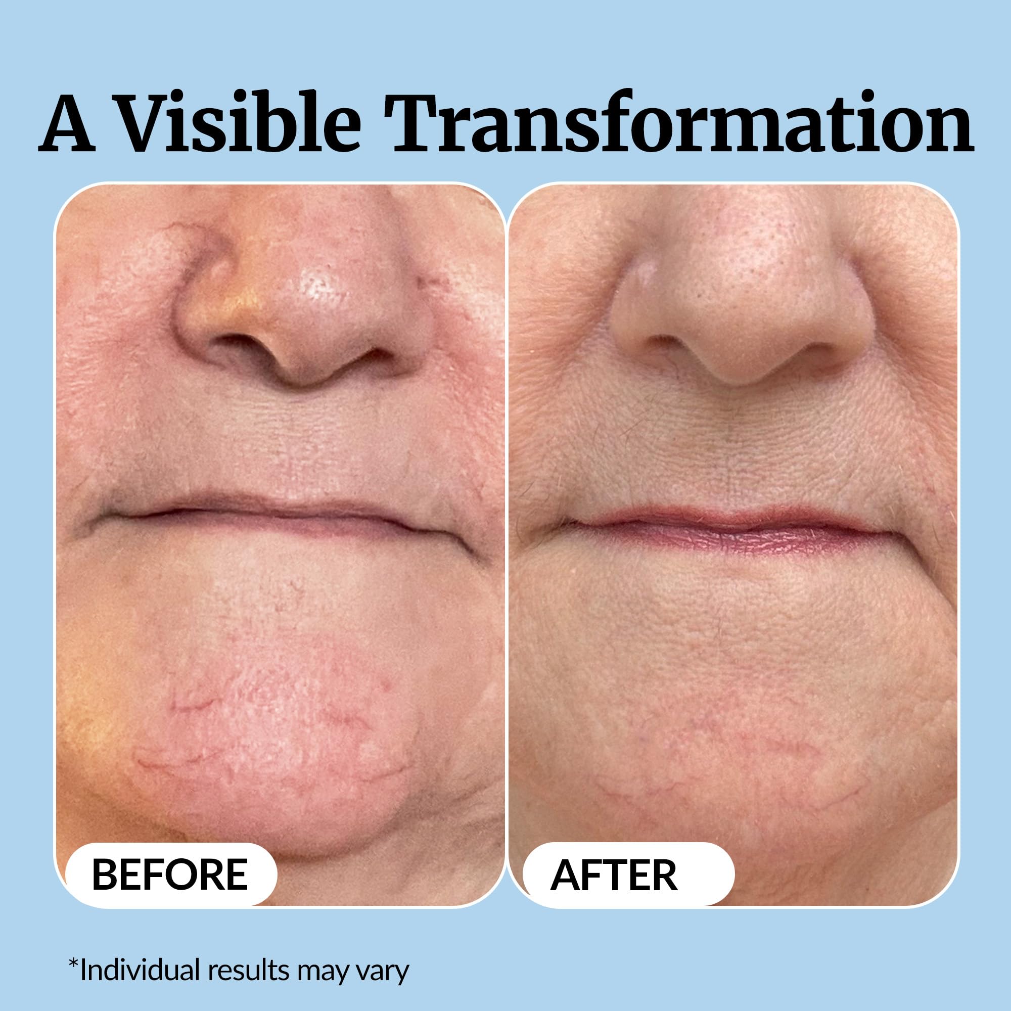 Vibriance Super C Serum for Mature Skin - All-in-One Vitamin Formula Hydrates, Firms, Lifts, Smooths, Targets Age Spots, Wrinkles, 1 fl oz Halalzen