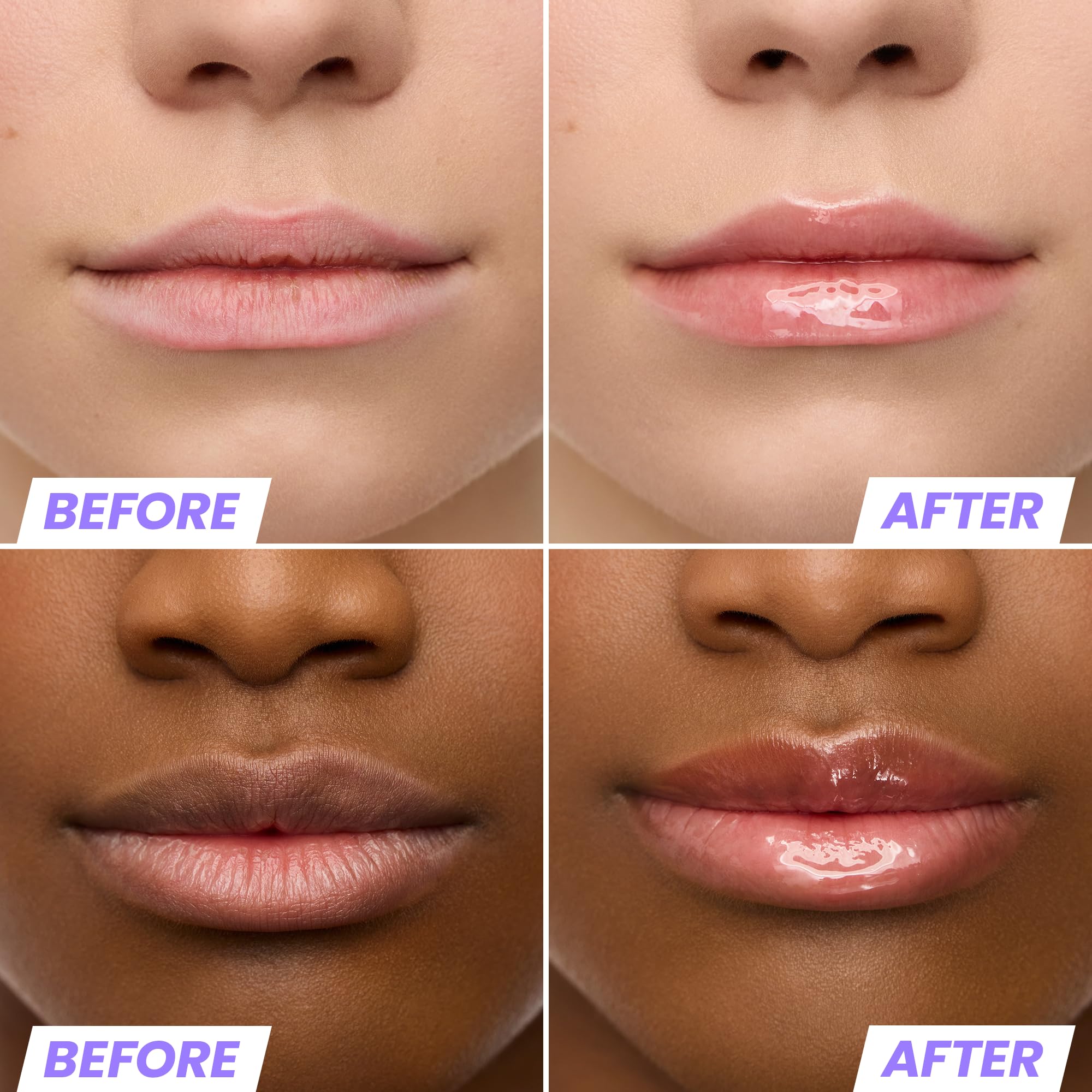 Wonderskin Lip Oil Rehab Serum - Tinted Lip Oil, Hydrating, Moisturizing, and Non-Sticky Deep Red Tint Serum for Dry Lips (Honey) Halalzen