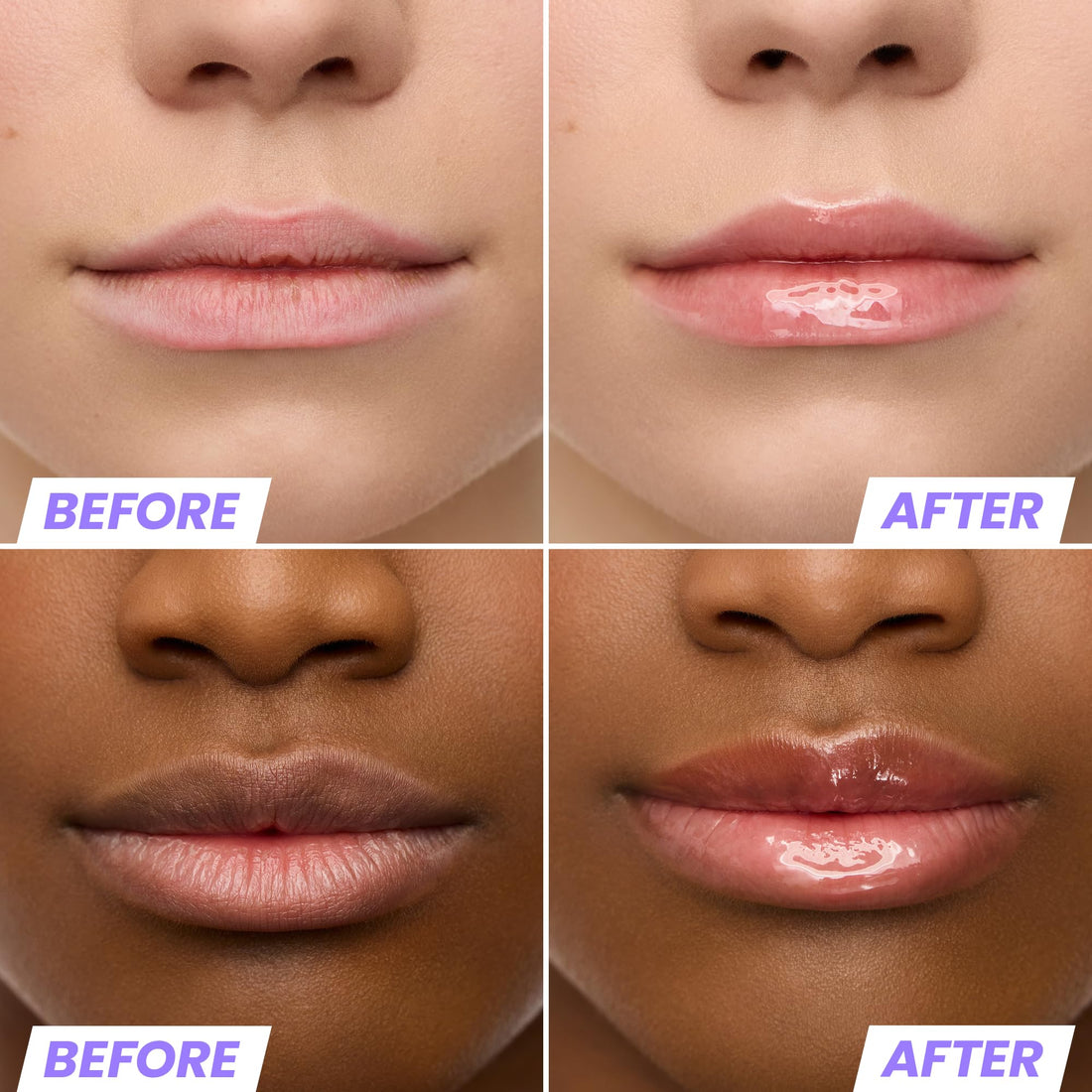 Wonderskin Lip Oil Rehab Serum - Tinted Lip Oil, Hydrating, Moisturizing, and Non-Sticky Deep Red Tint Serum for Dry Lips (Honey) Halalzen