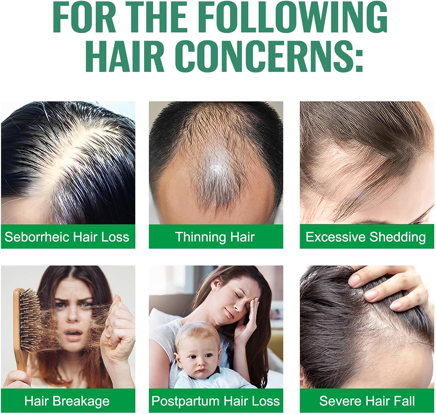 Hair Growth Serum Spray 120ml with Biotin, Rosemary & Castor Oil - Natural Hair Loss Treatment & Thickening Scalp Care with Batana Oil, Caffeine & Ginseng - For Women & Men, All Hair Types