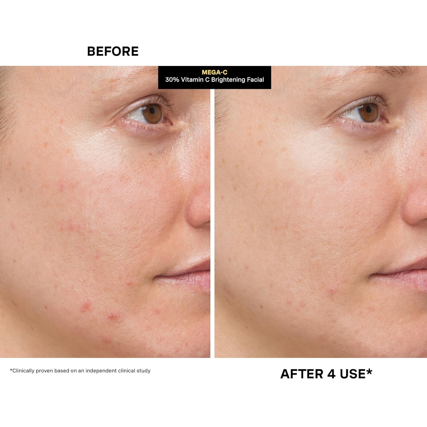 Kate Somerville Mega-C 30% Vitamin C Brightening Facial Mask – Clinic-Grade Treatment to Brighten, Even Skin Tone & Firm, 2 Fl Oz Halalzen