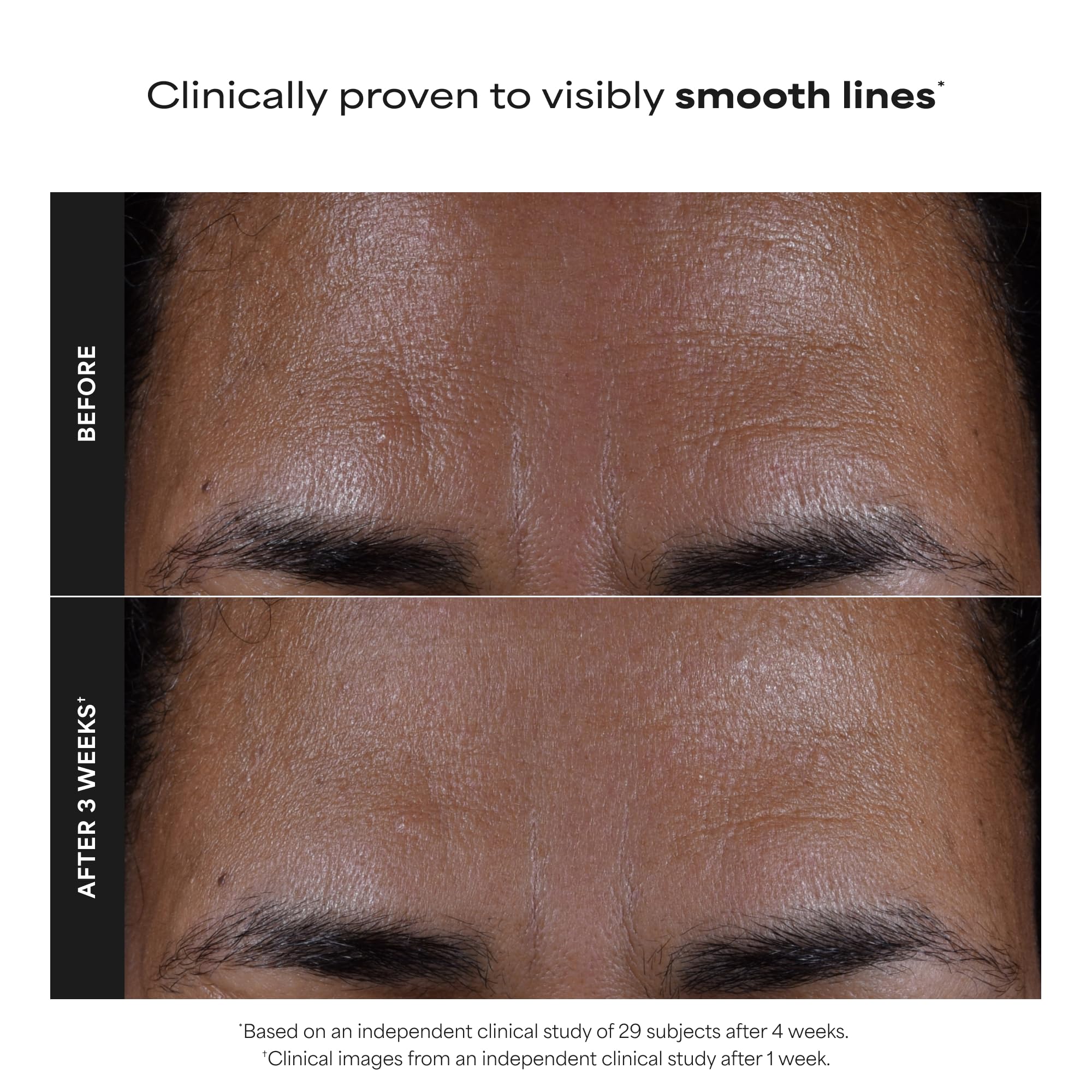 Paula's Choice SKIN PERFECTING 2% BHA Liquid Exfoliant - Face Exfoliating Peel Fights Blackheads & Enlarged Pores - for a Healthy Glow - with Salicylic Acid - Combination & Oily Skin - 30 ml