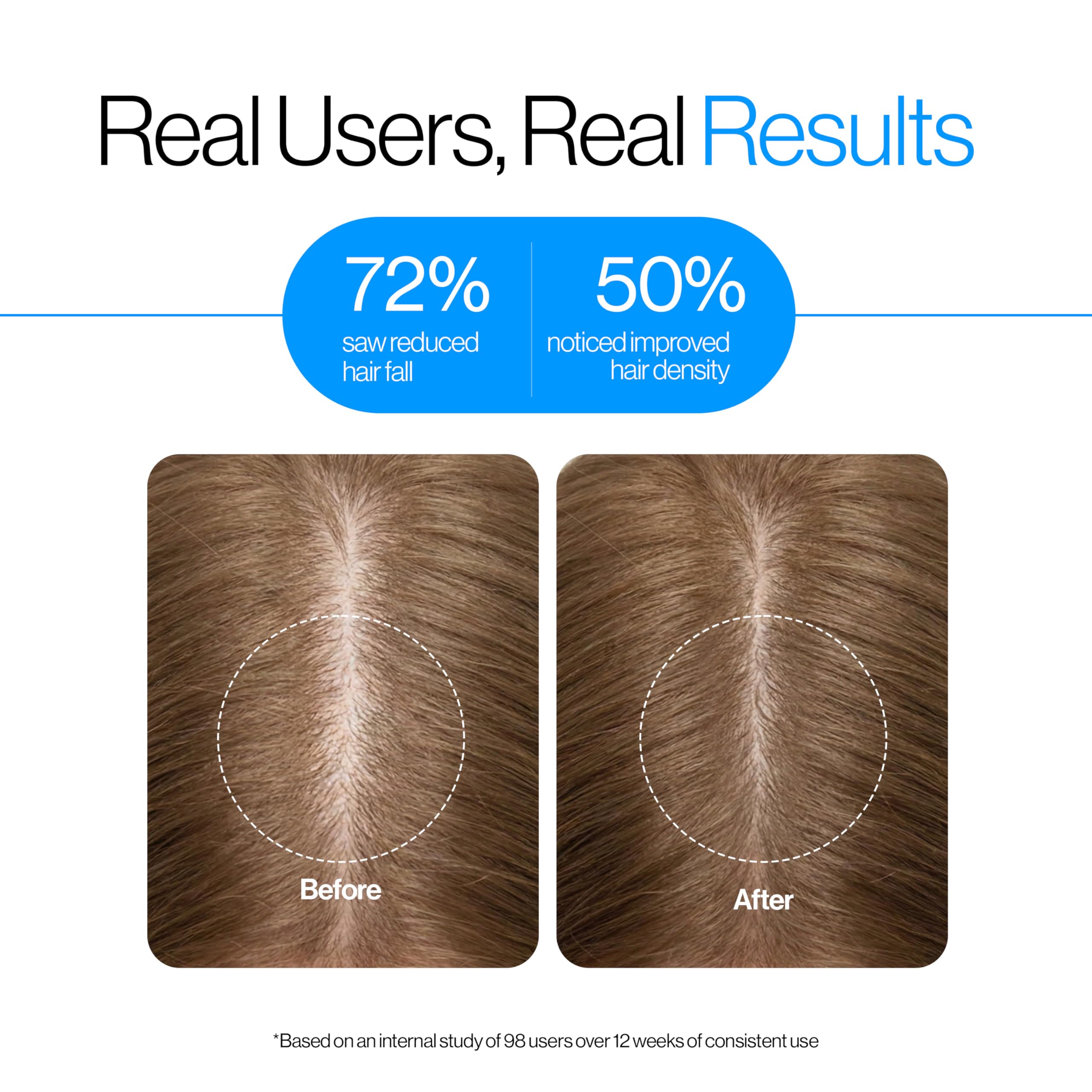 Be Bodywise Rosemary Hair Growth Serum (Roll On) | 3% Redensyl & 2% Anagain | Hair fall control serum for Women & Men | Promotes Hair Growth & Stimulates Hair Follicles | For All Hair Types | 25ml